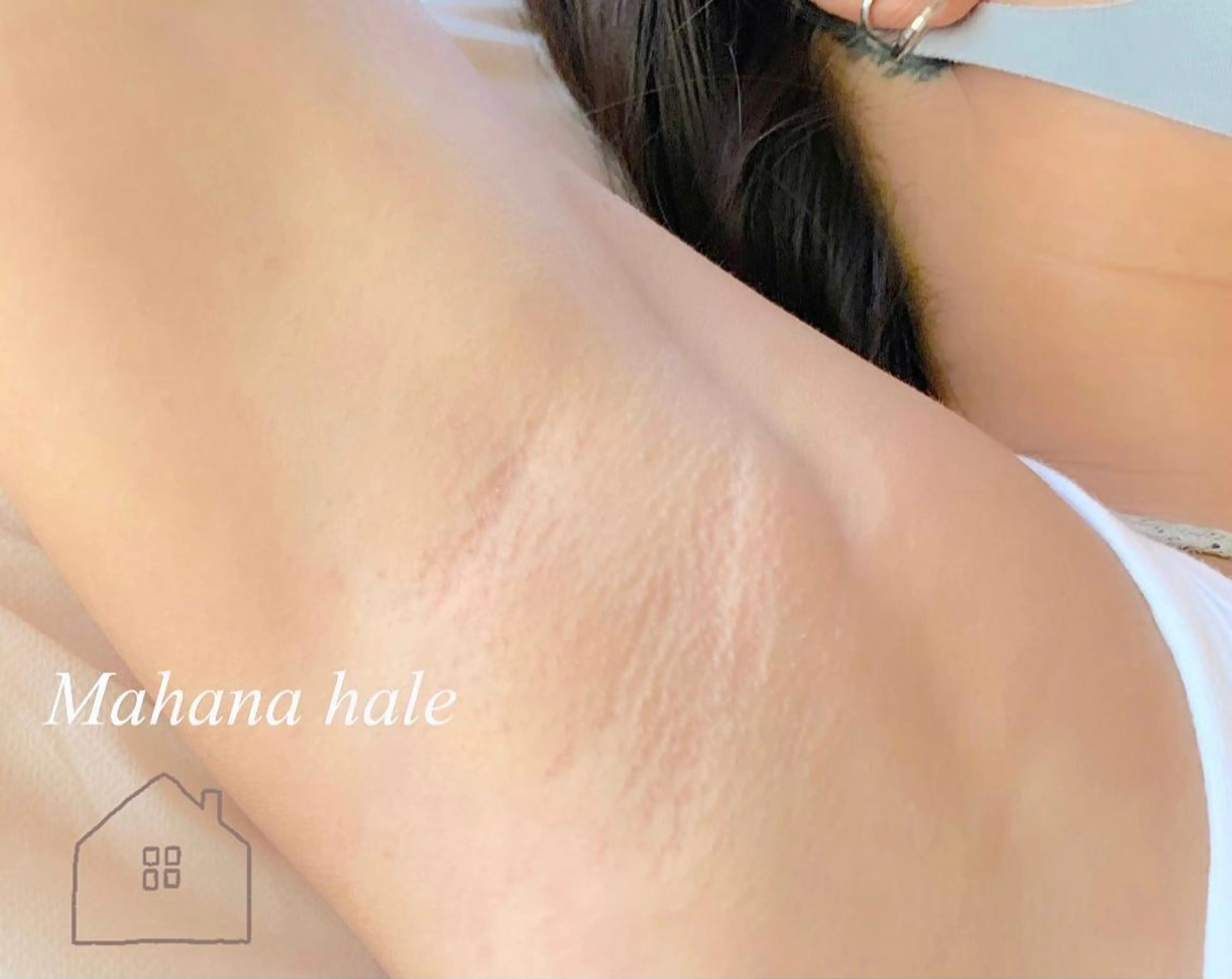 【シュガーリング】 両脇の写真