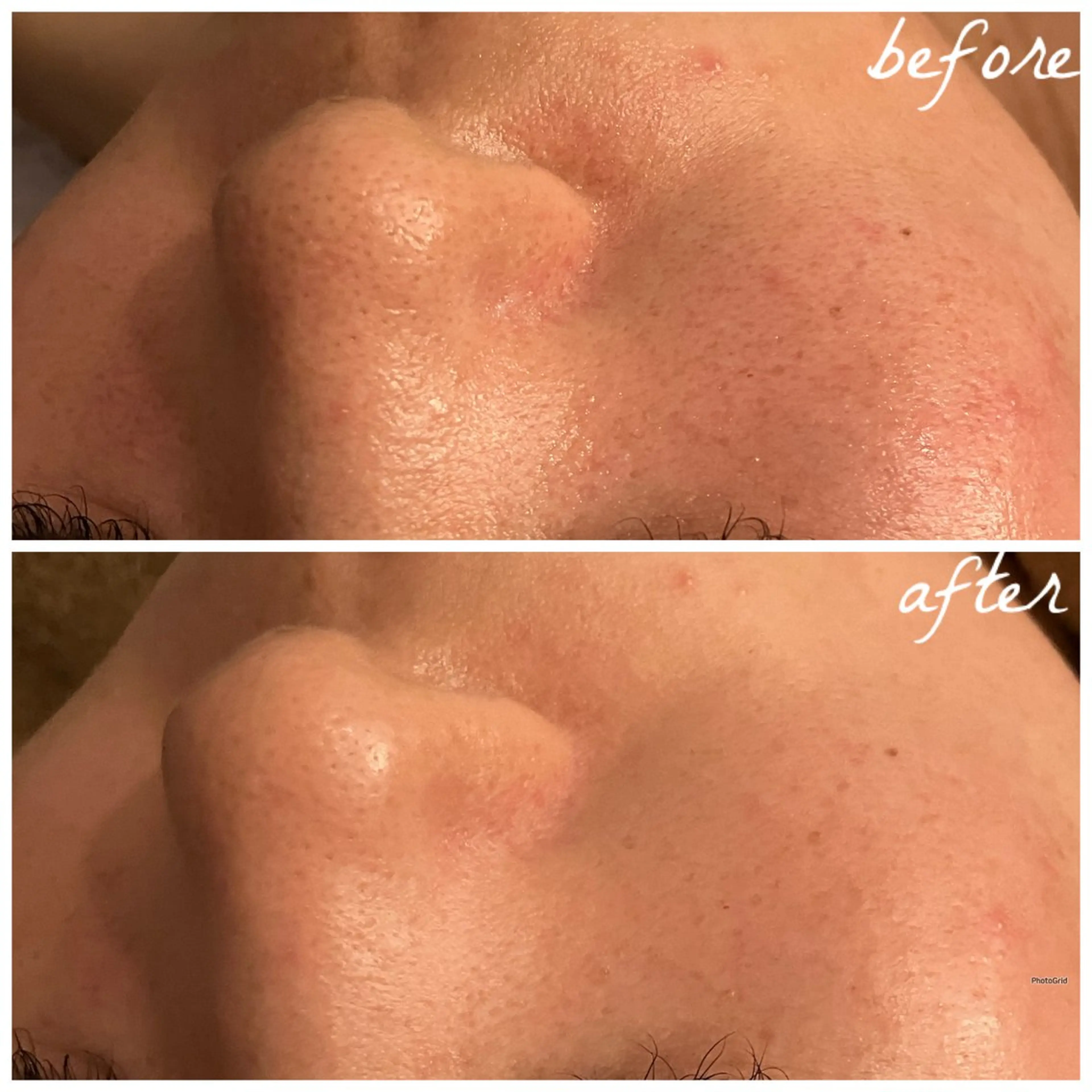 メンズ メナード岐阜茜部 杉浦のエステ・リラクイメージ