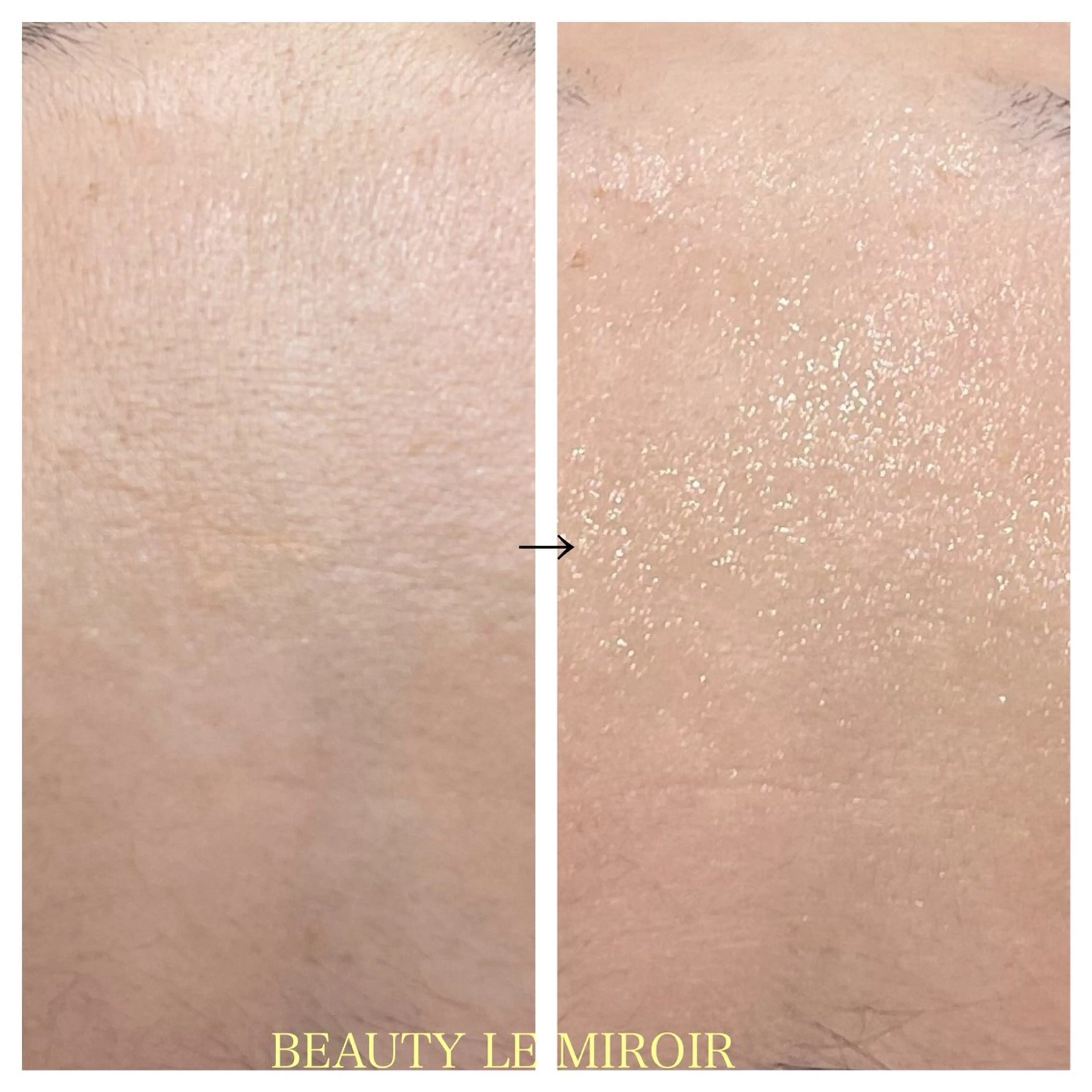 ビューティー ミロワールのエステ・リラクイメージ