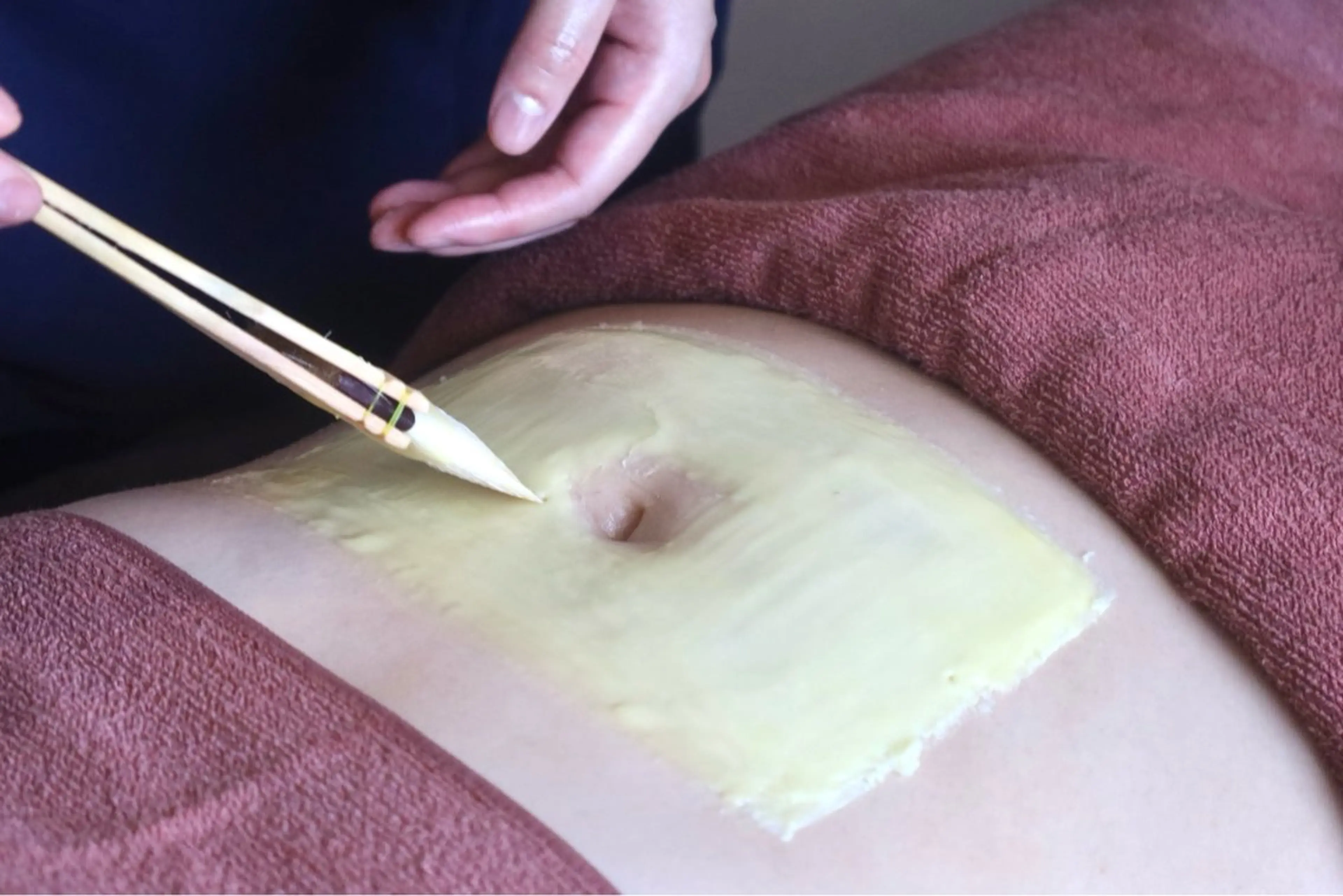 エステ リラク ニキビ特化型エステ 🍓最短で肌質改善のその他イメージ