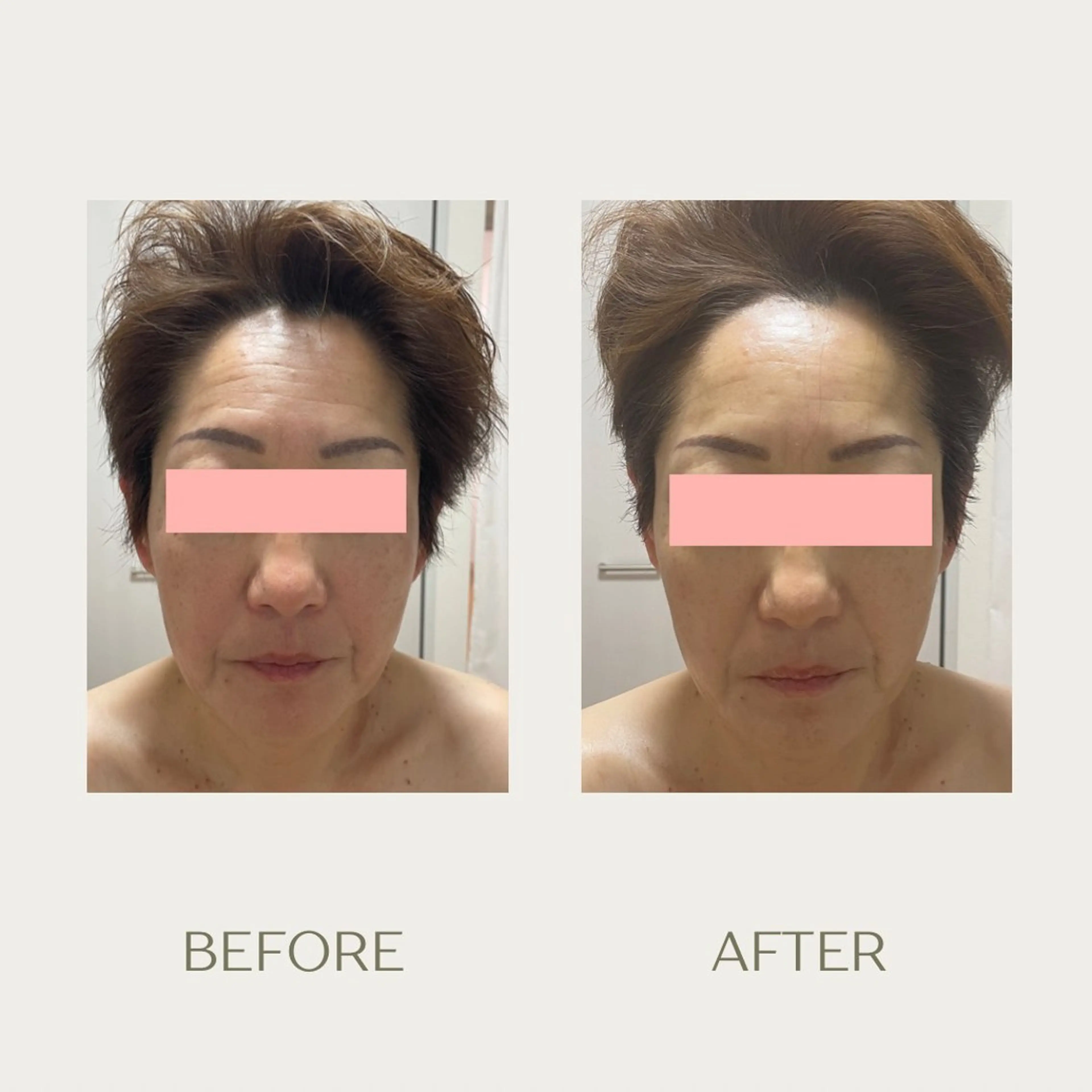 ピーリングケア 🤍moekoのエステ・リラクイメージ