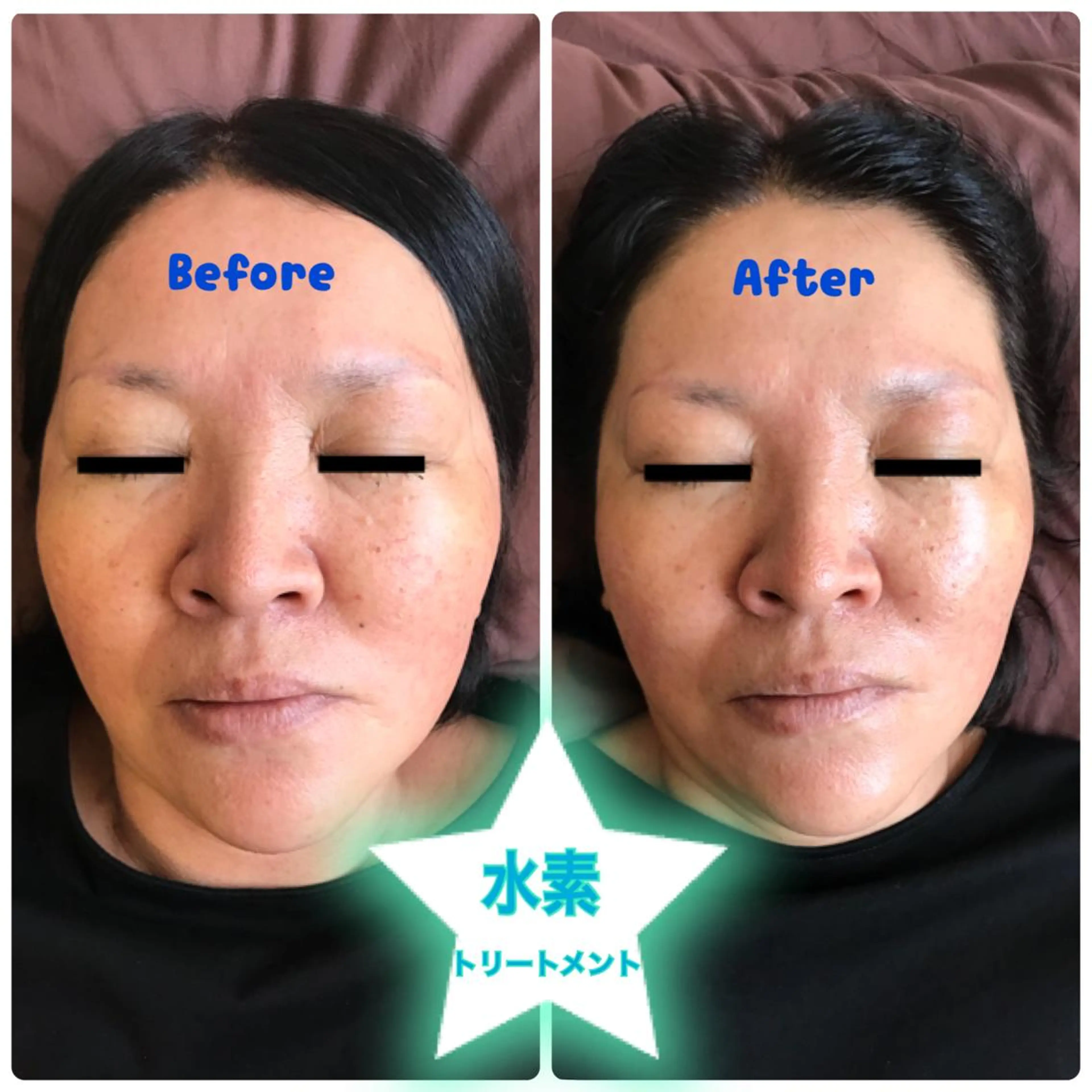 代表 MOMOのエステ・リラクイメージ