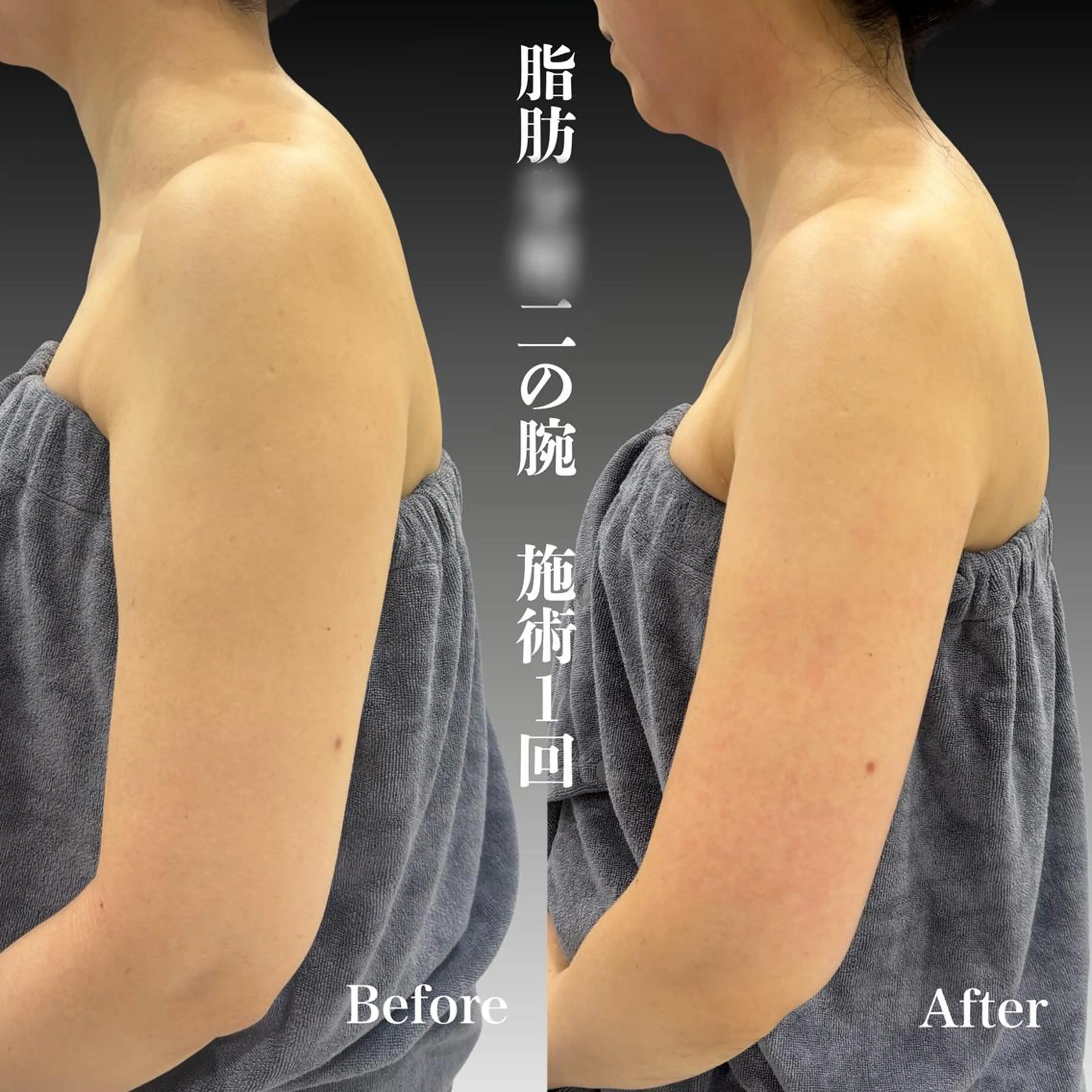 心斎橋🤍堀江.小顔 ハーブ.痩身クレビアのエステ・リラクイメージ