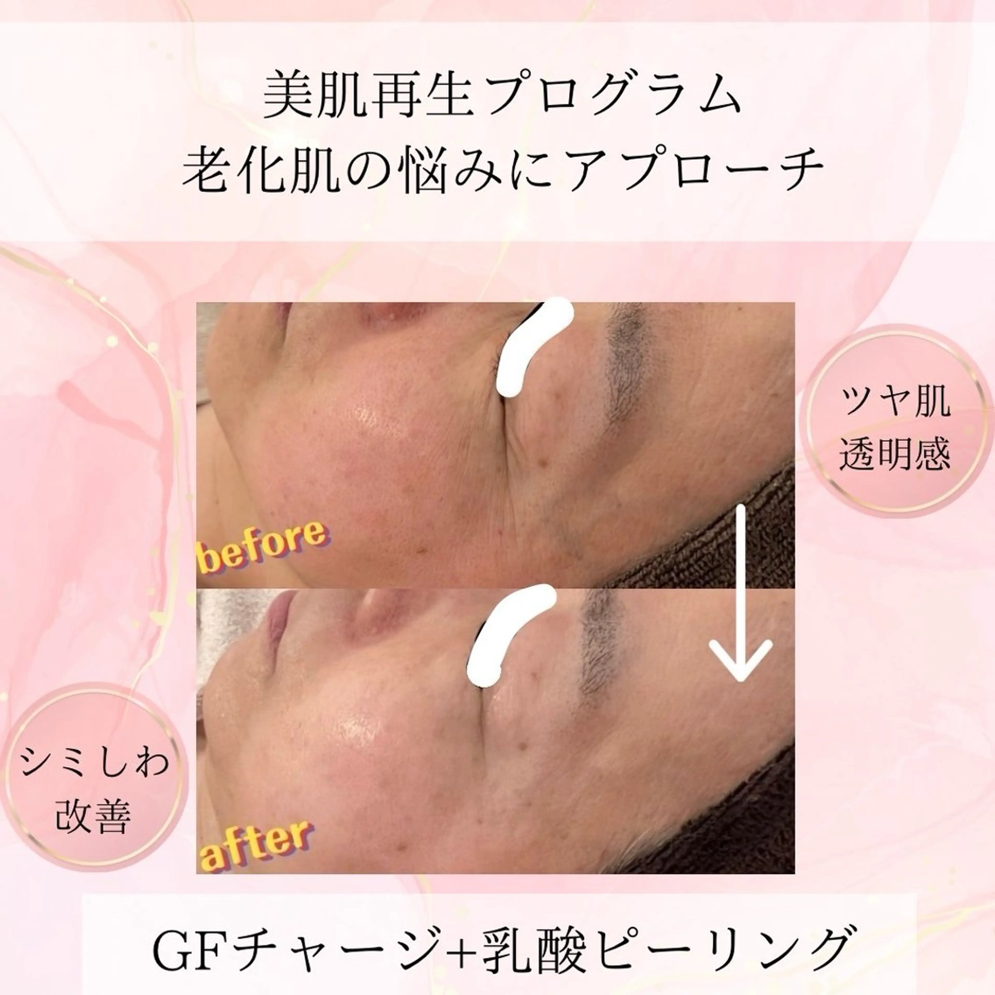 beauty SalonRcoinのマツエク・マツパデザイン