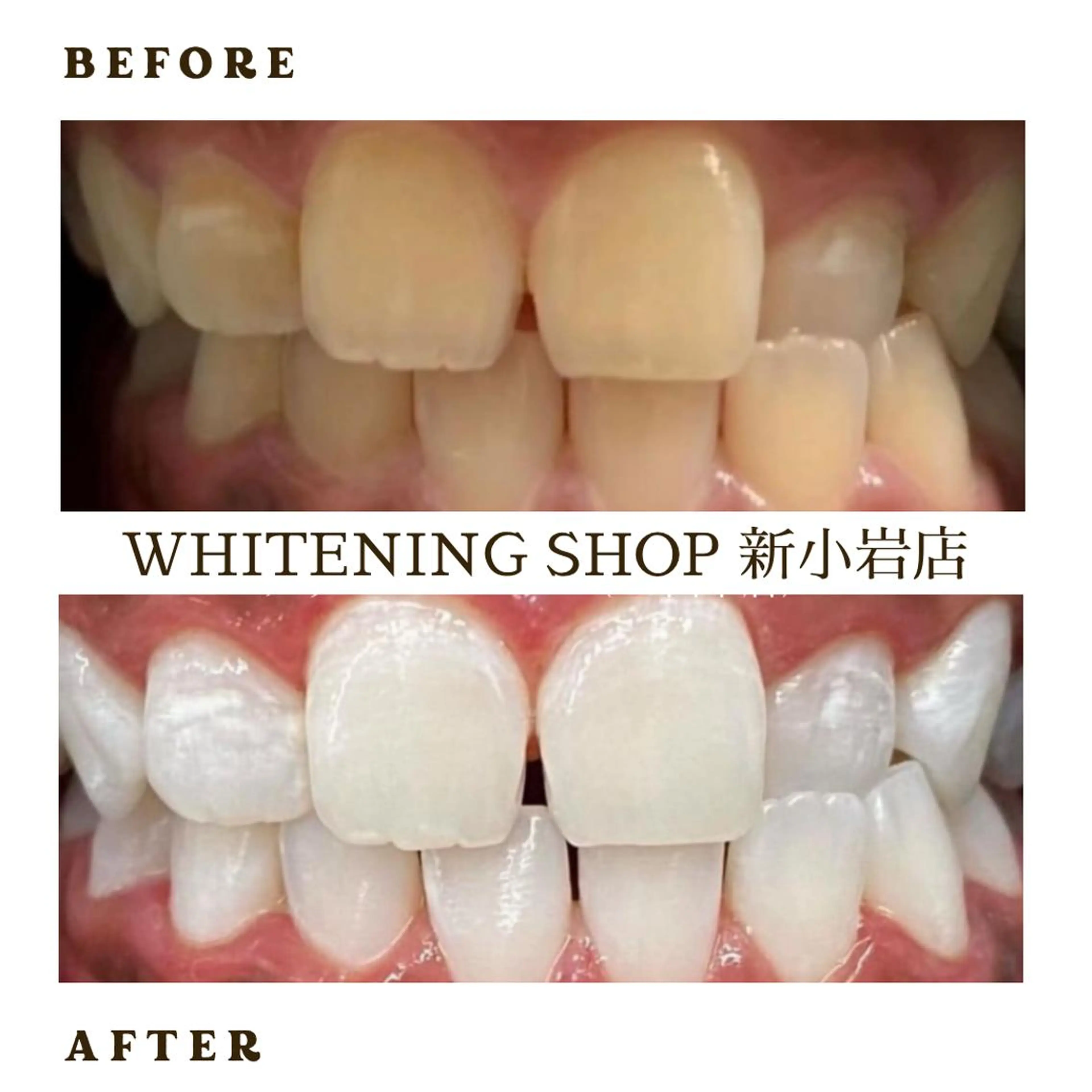 メンズ その他 ホワイトニング ショップ新小岩店のその他イメージ