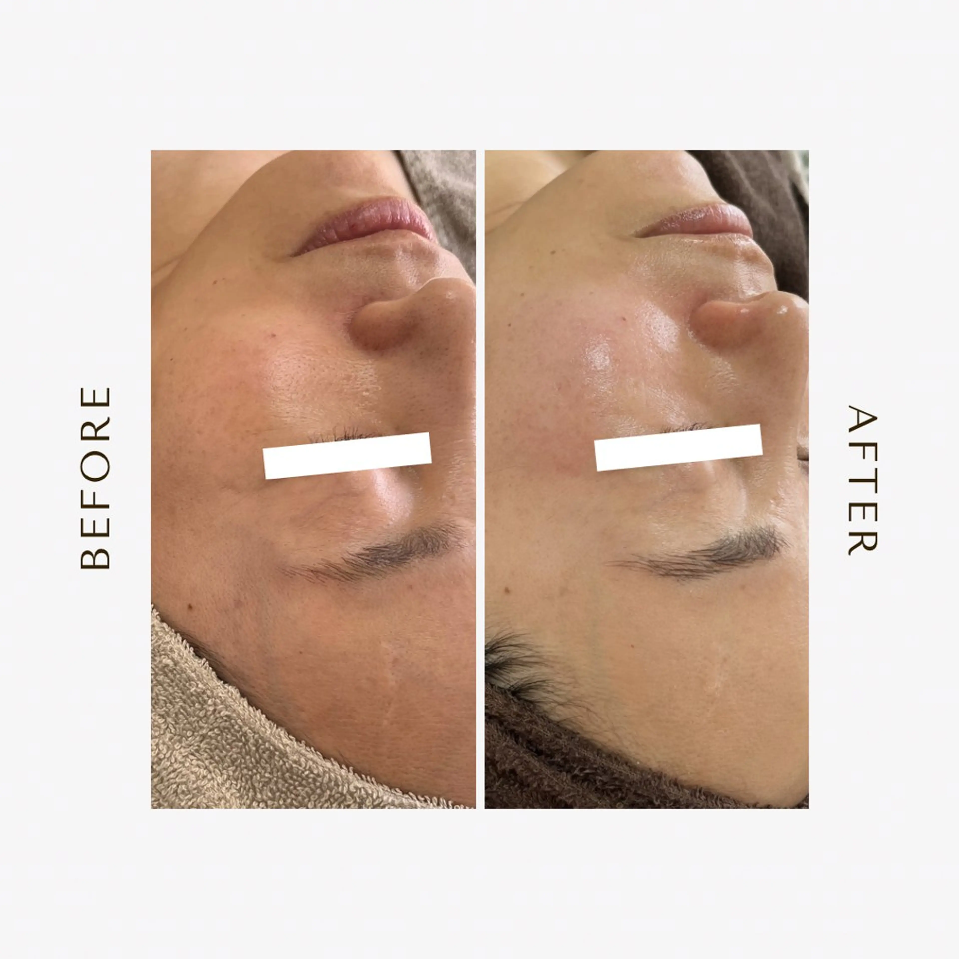 エステ 1st｜フェイシャル エステ専門店のエステ・リラクイメージ