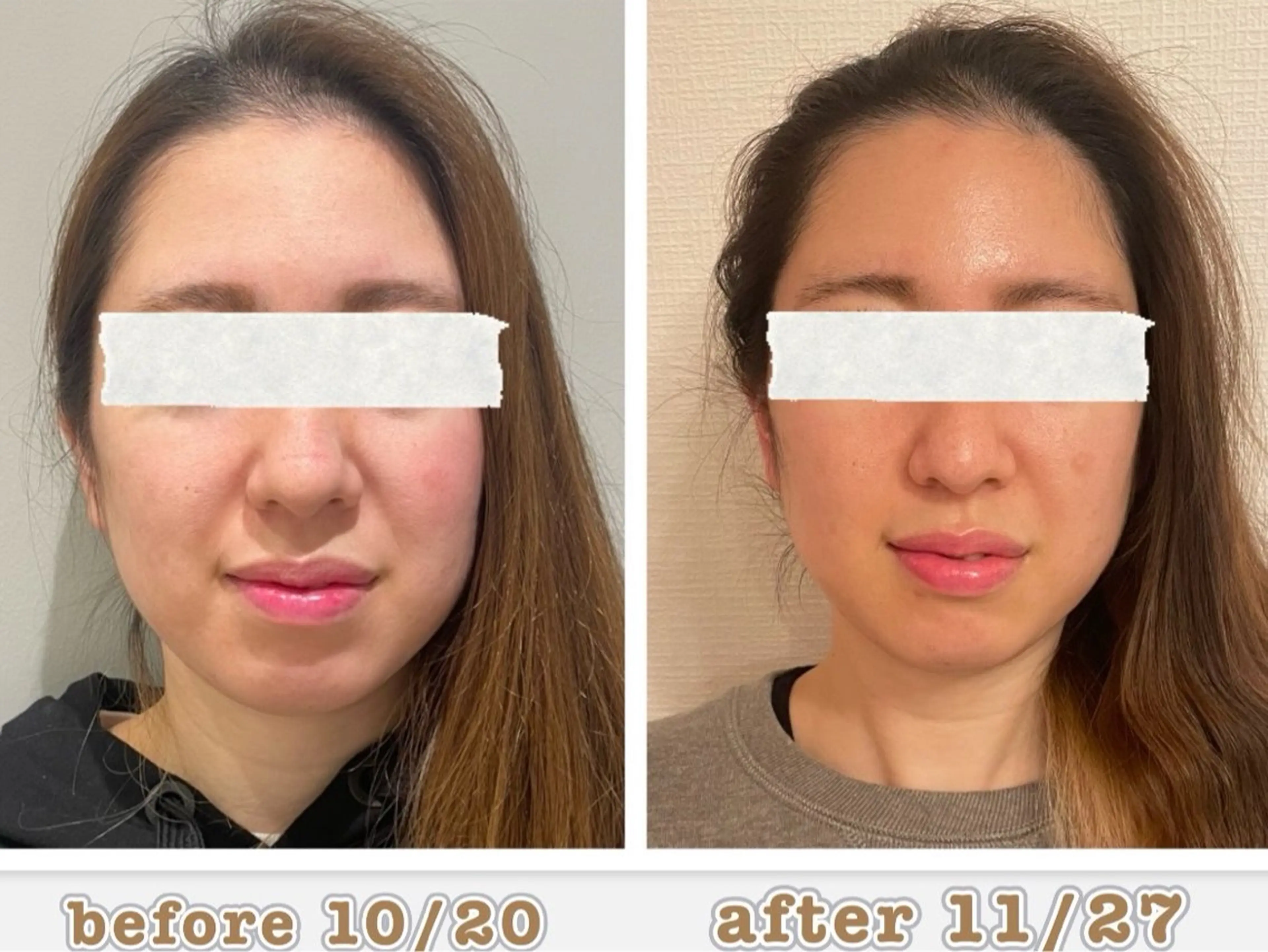 LastResort 荒尾のエステ・リラクイメージ