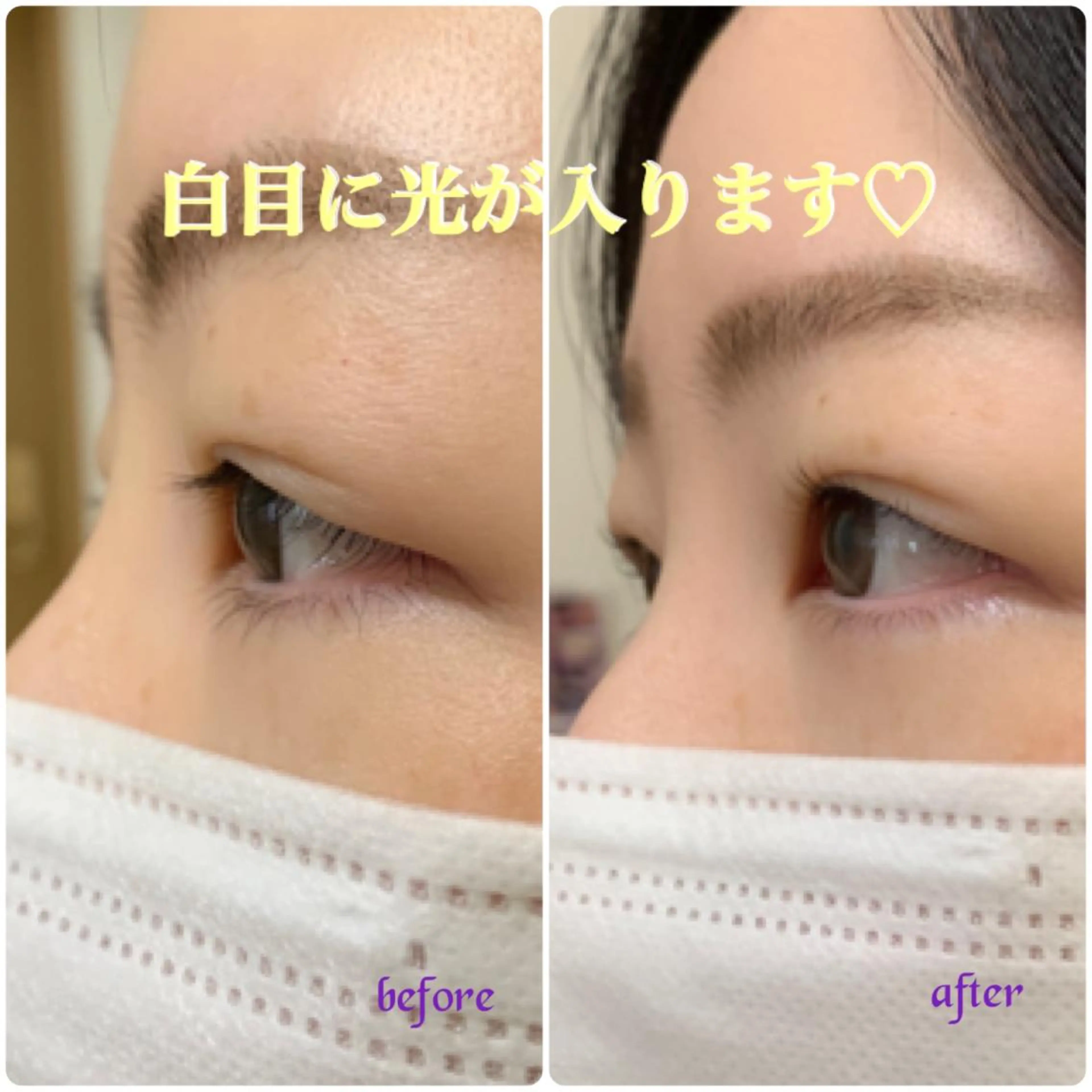 マツエク・マツパ B  peace beauty salon所属・B peace. はるかのマツエク・マツパデザイン