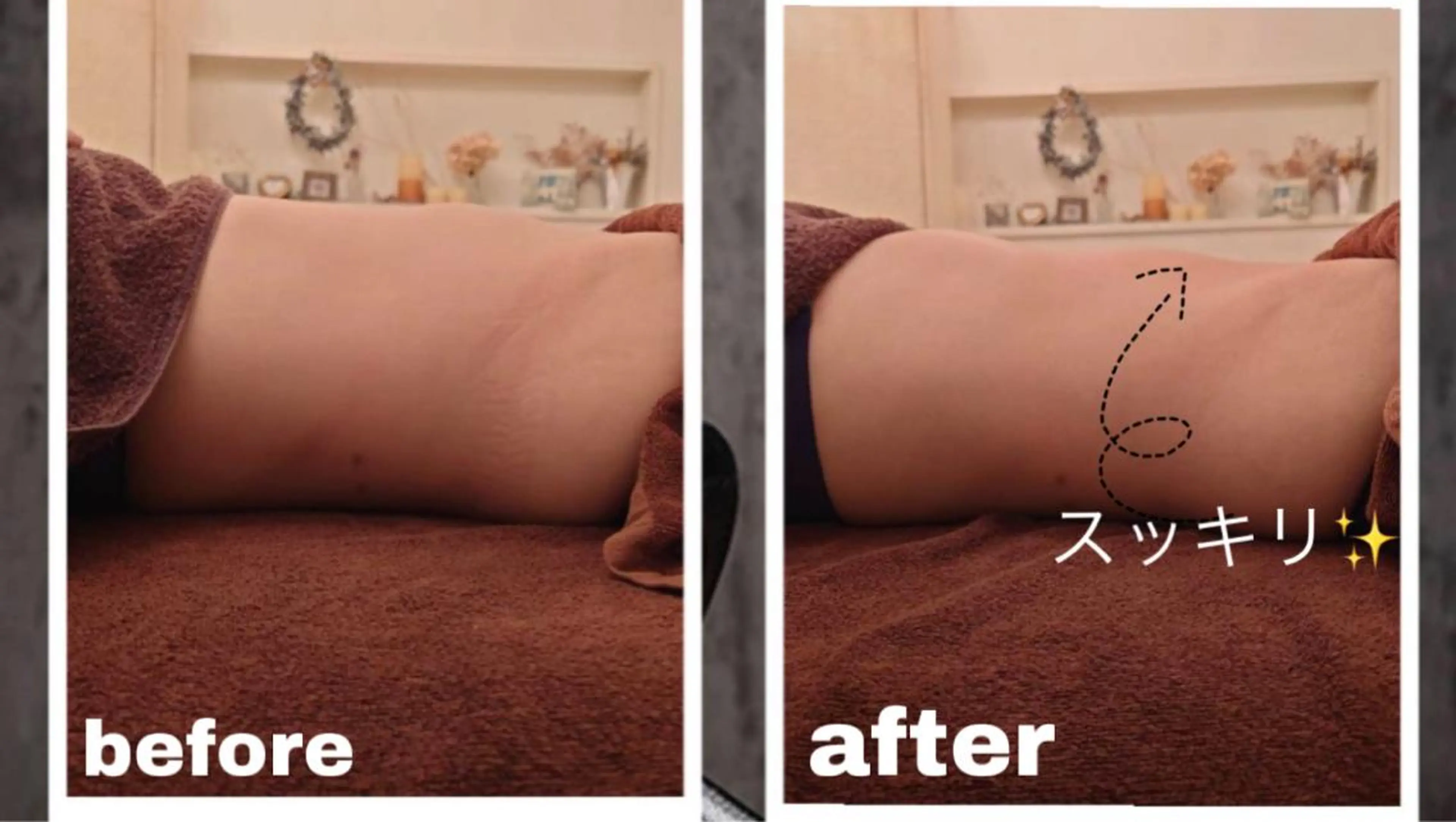 脱毛・痩身強化サロン リアンメルシー佐々木のエステ・リラクイメージ