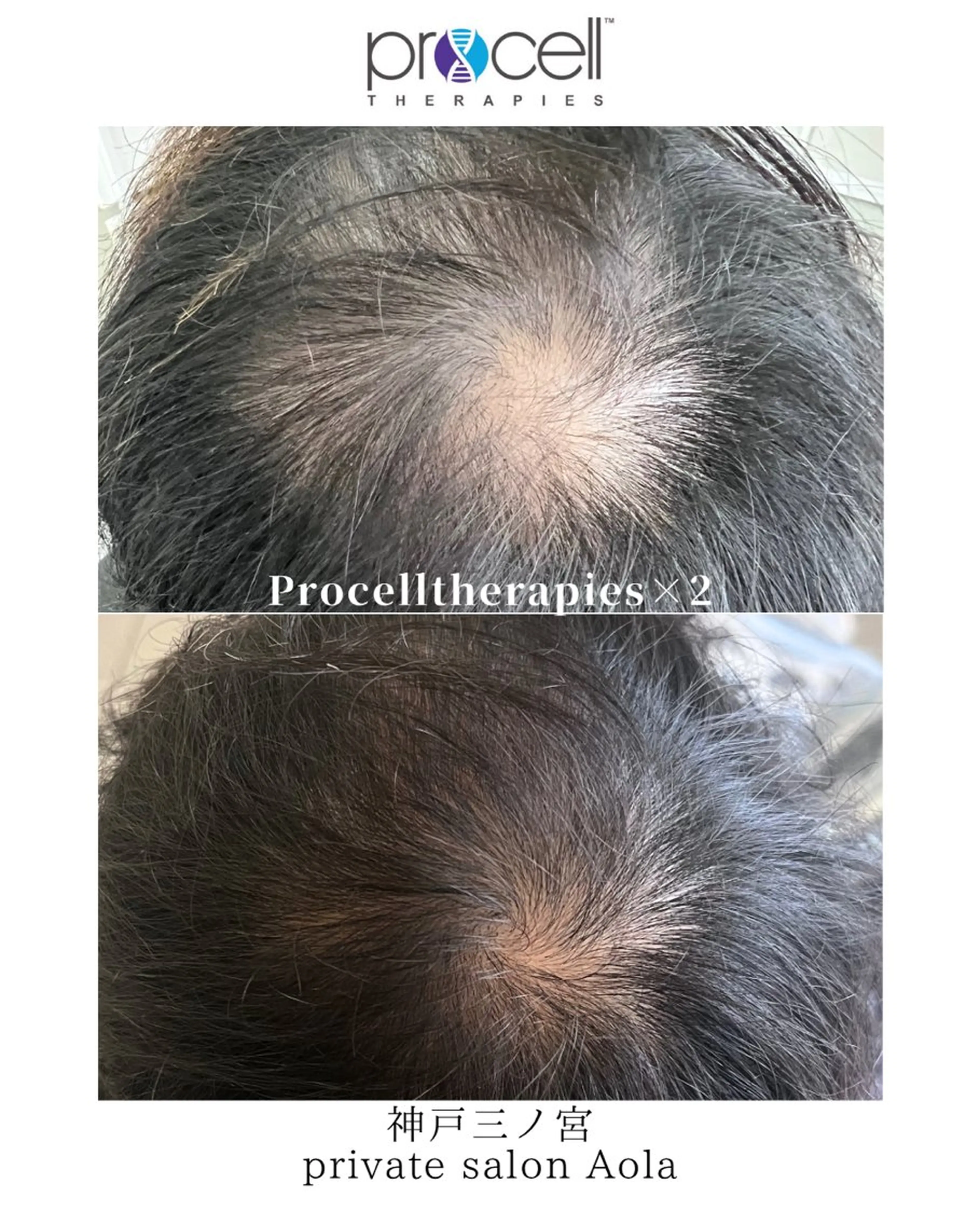 private salon Aola所属・プライベートサロン アオラのネイルデザイン