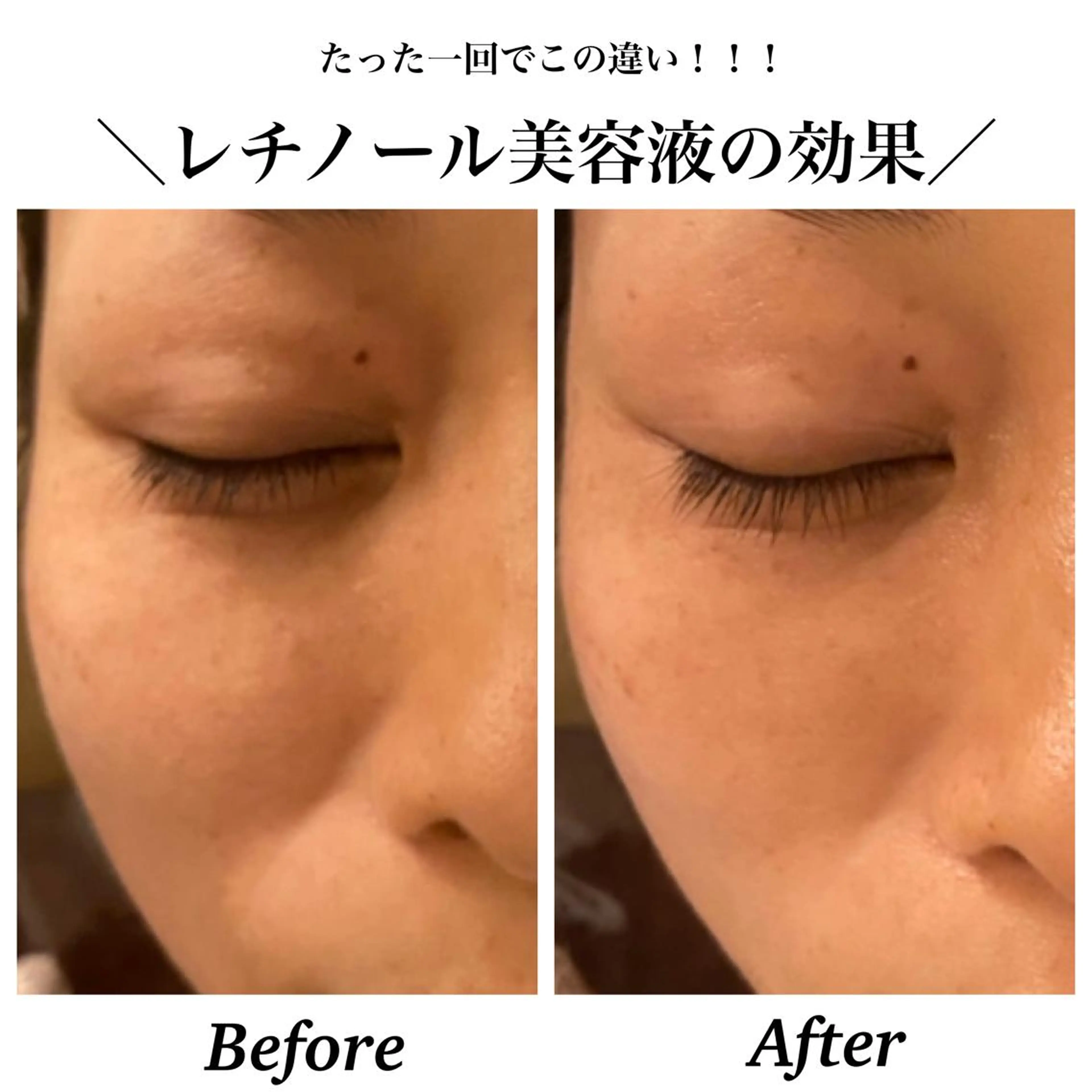 エステ リラク Bellesthe （ベルエステ）のエステ・リラクイメージ