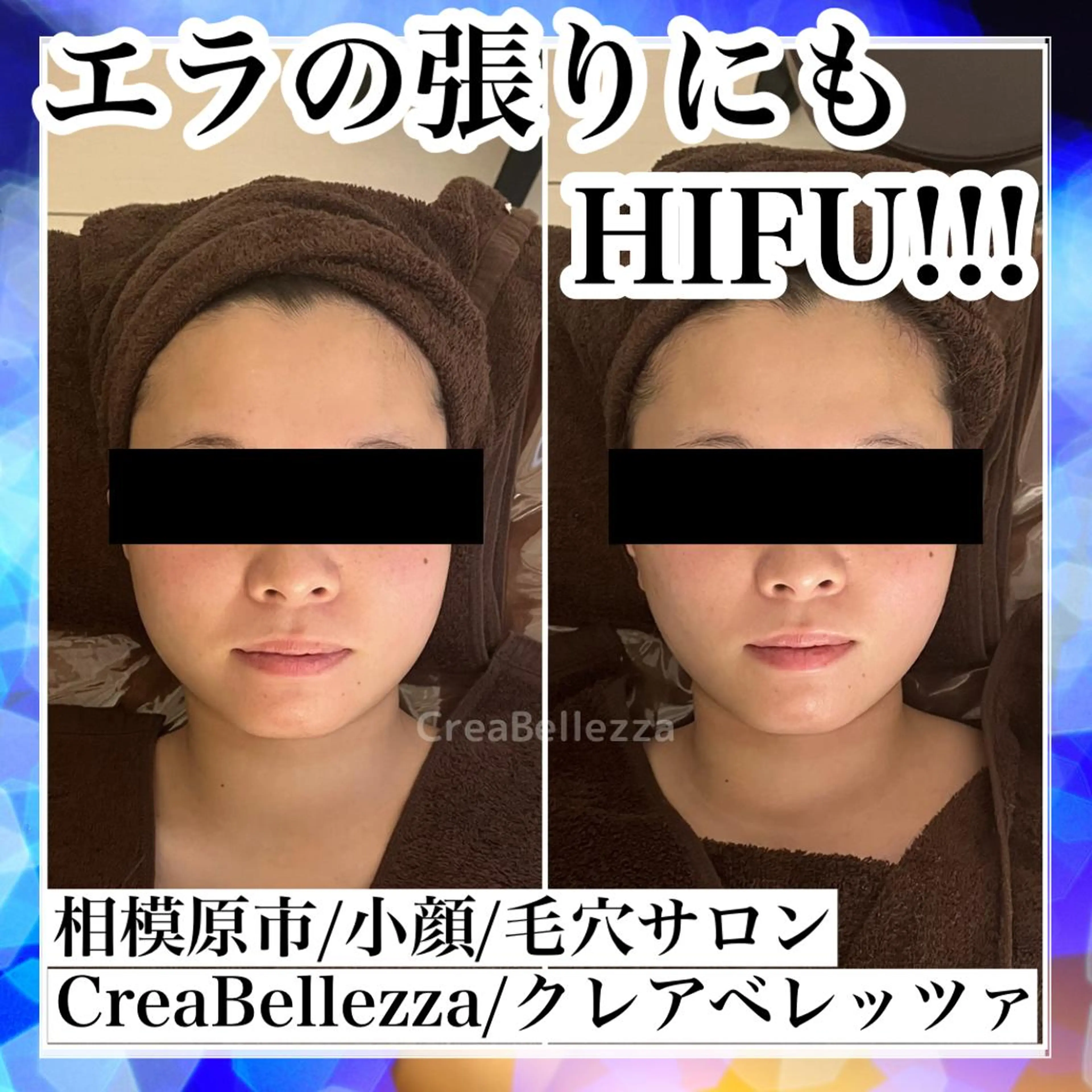 エステ 毛穴/肌質改善サロン クレアベレッツァのエステ・リラクイメージ