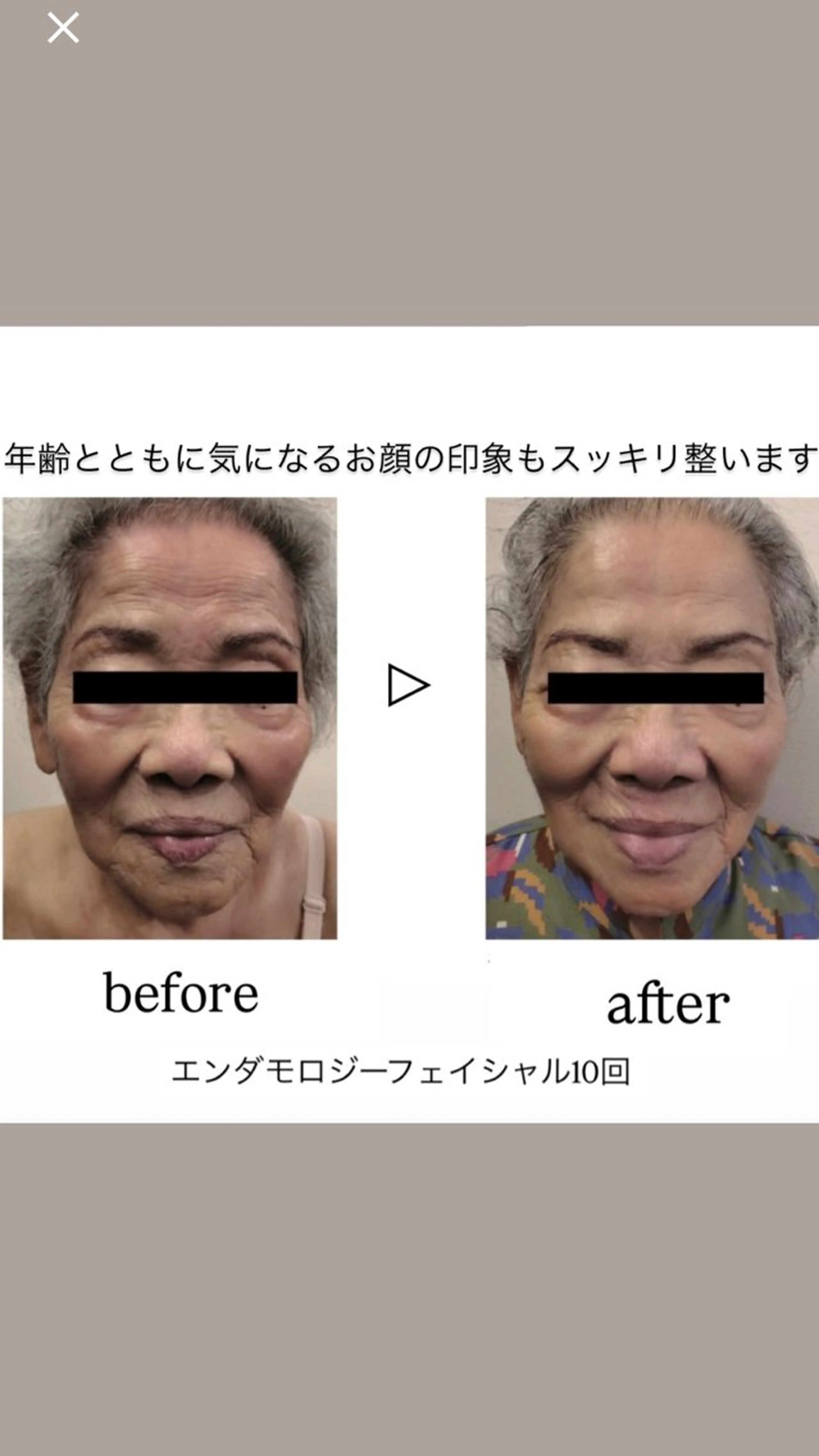 エステ Binosu所属・エンダモロジー BINOSUのエステ・リラクイメージ