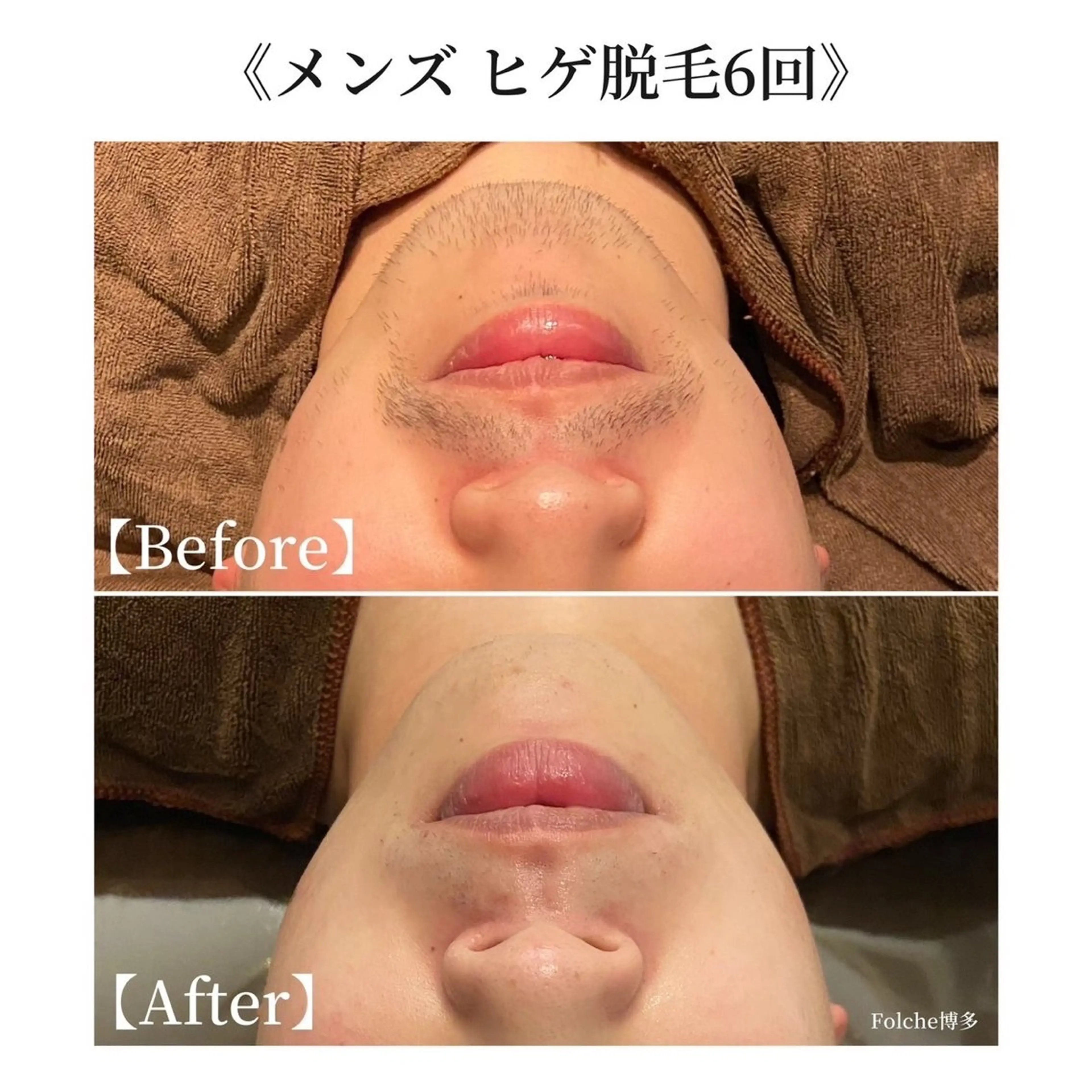 folche春日店 坪井のエステ・リラクイメージ