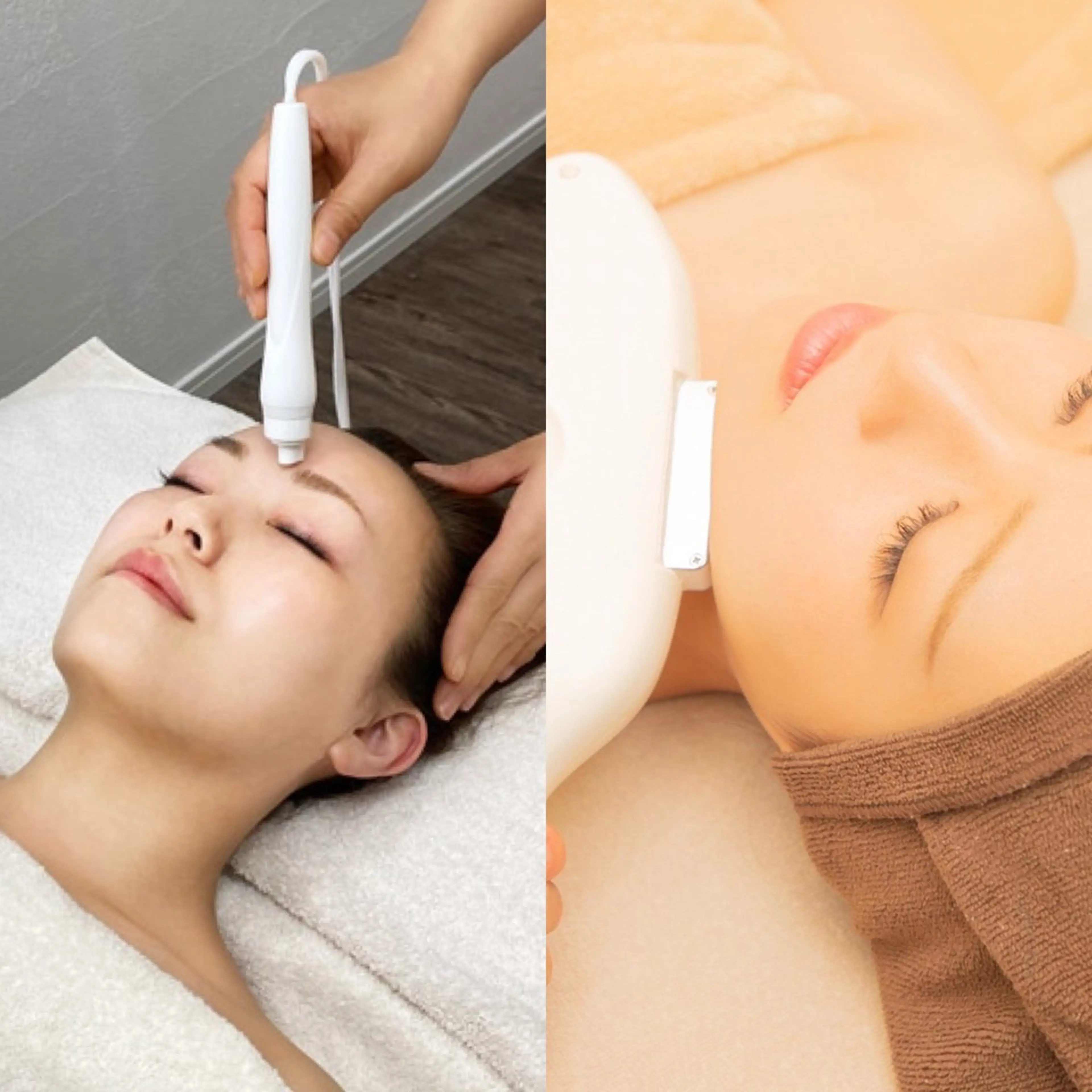 【むくみ解消/ニキビ/ニキビ跡/美白ケア/毛穴引き締め】スペシャルケア⭐️光フォト×毛穴洗浄の写真