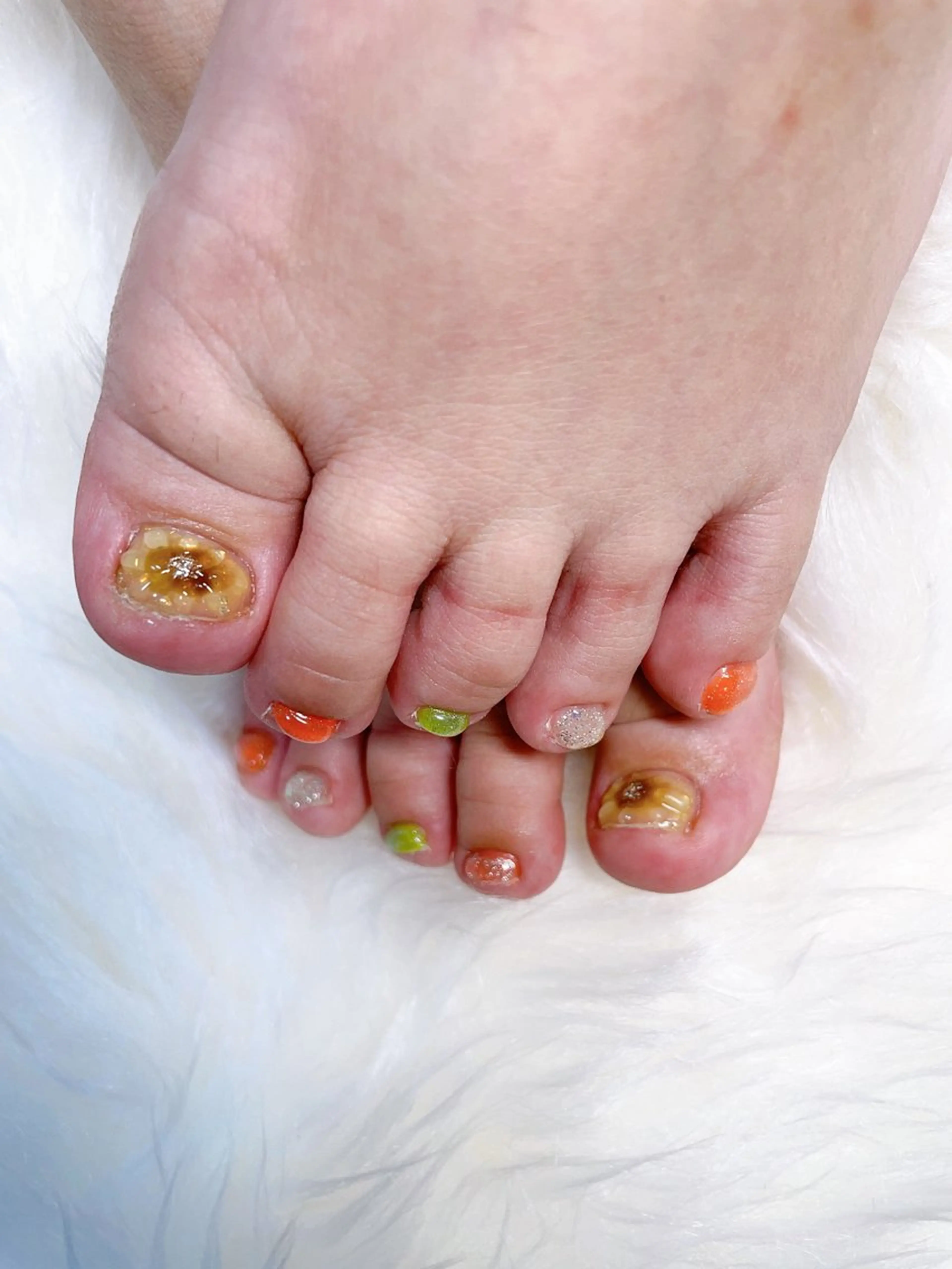 ネイル フットネイル GAL_ NAILのネイルデザイン