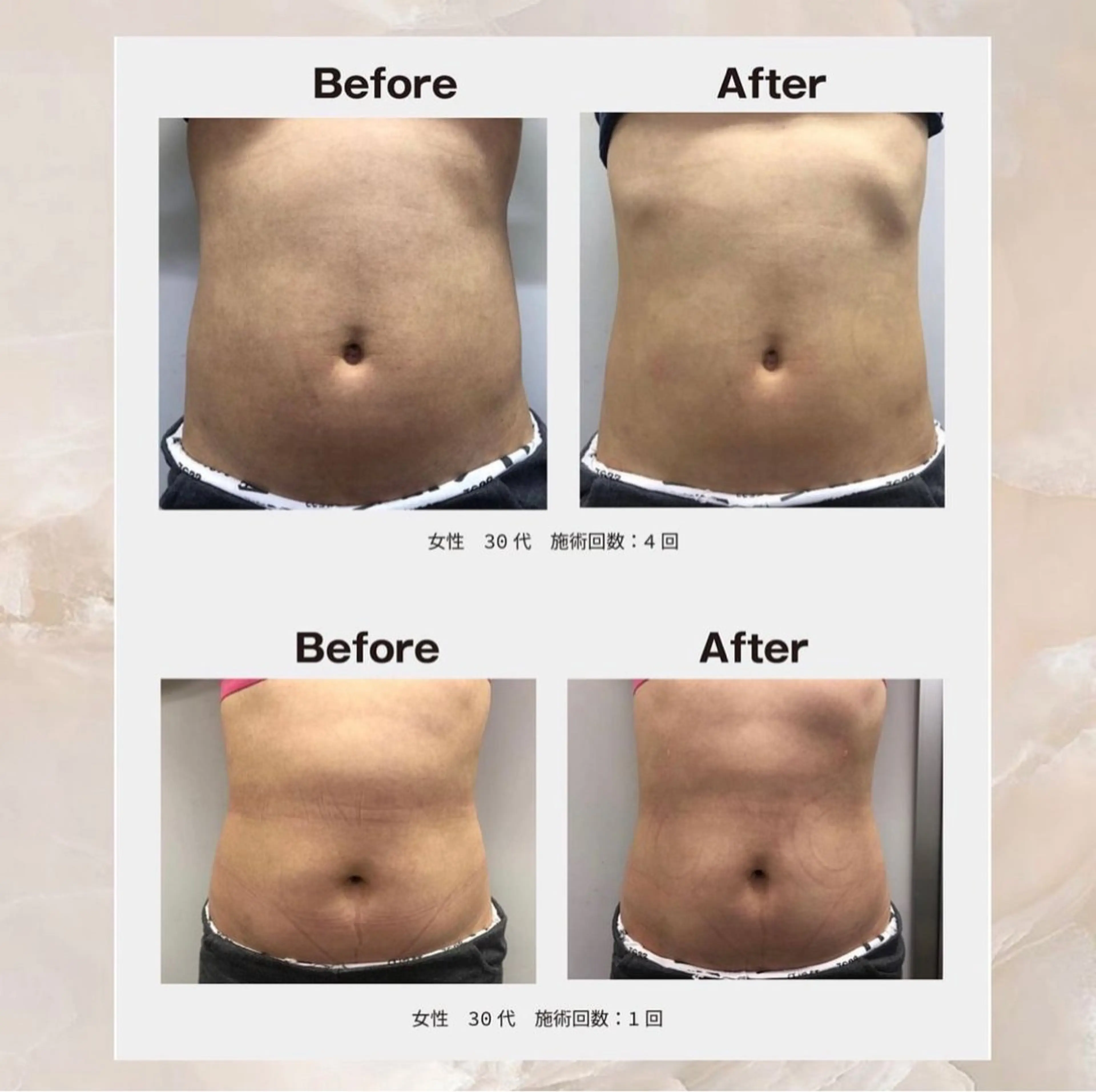 エステ 🦋美肌サロン. maho🦋のエステ・リラクイメージ