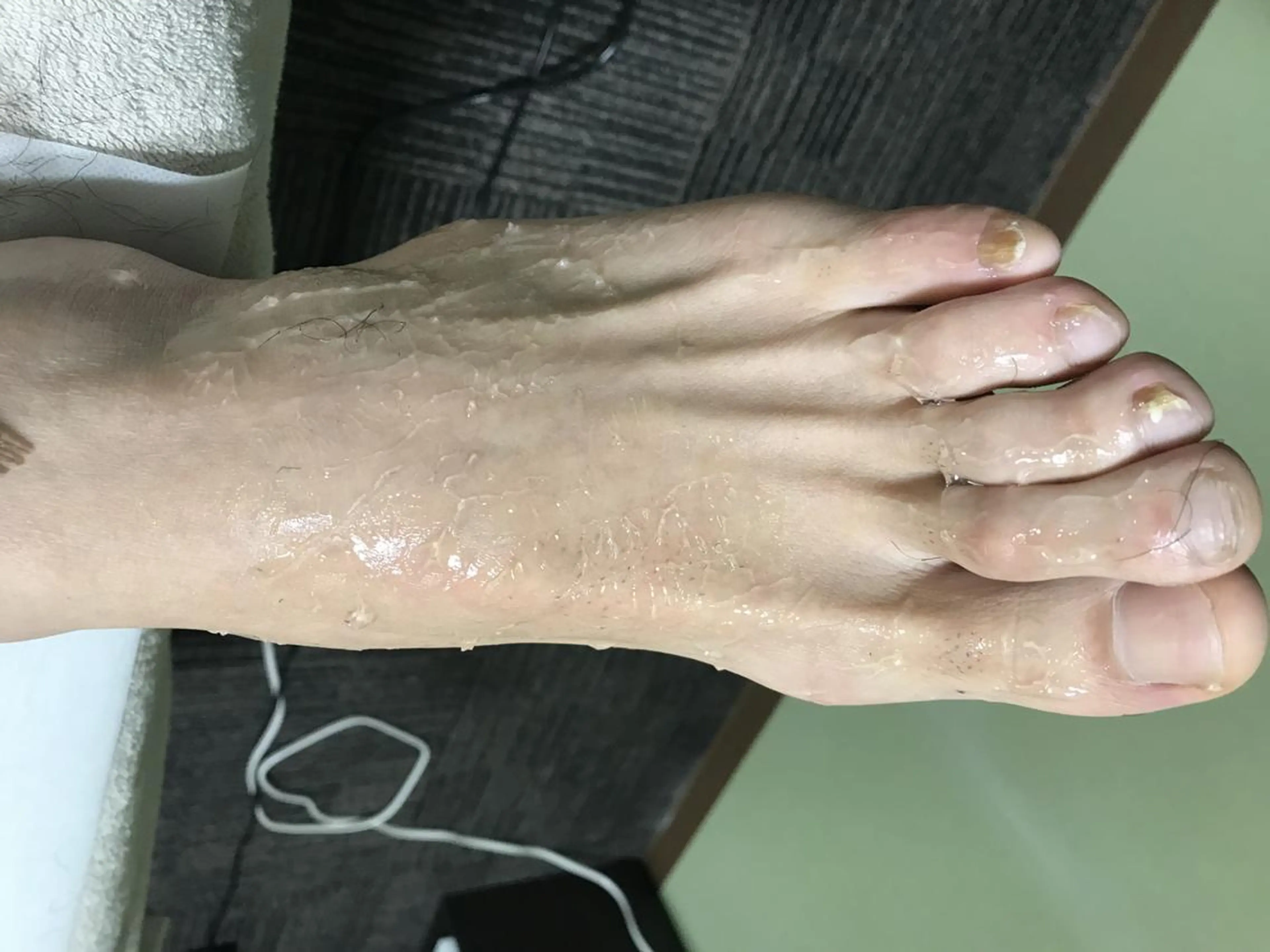 メンズ マンモス脱毛 札幌白石店のその他イメージ