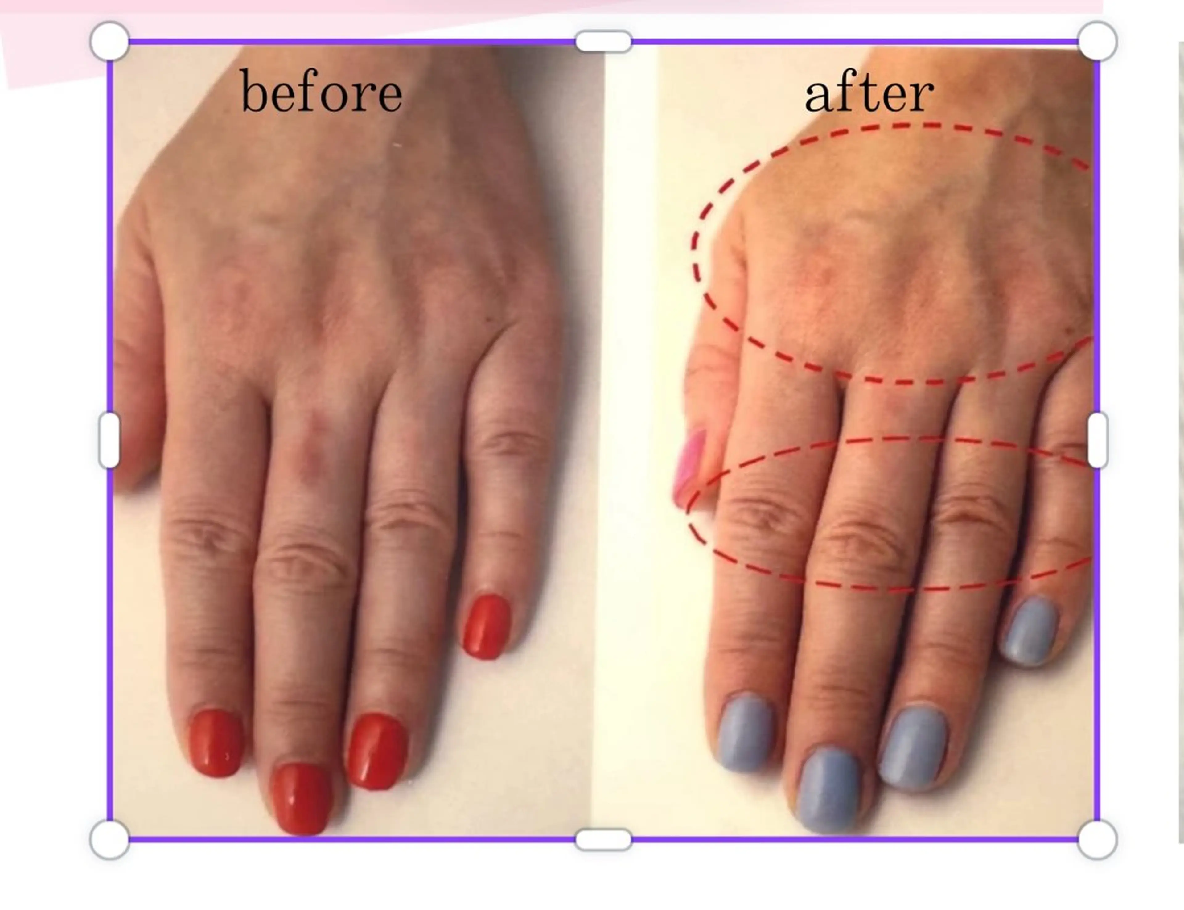 ネイル ハンドネイル ハンドケア nail salon ily 武蔵新城のネイルデザイン