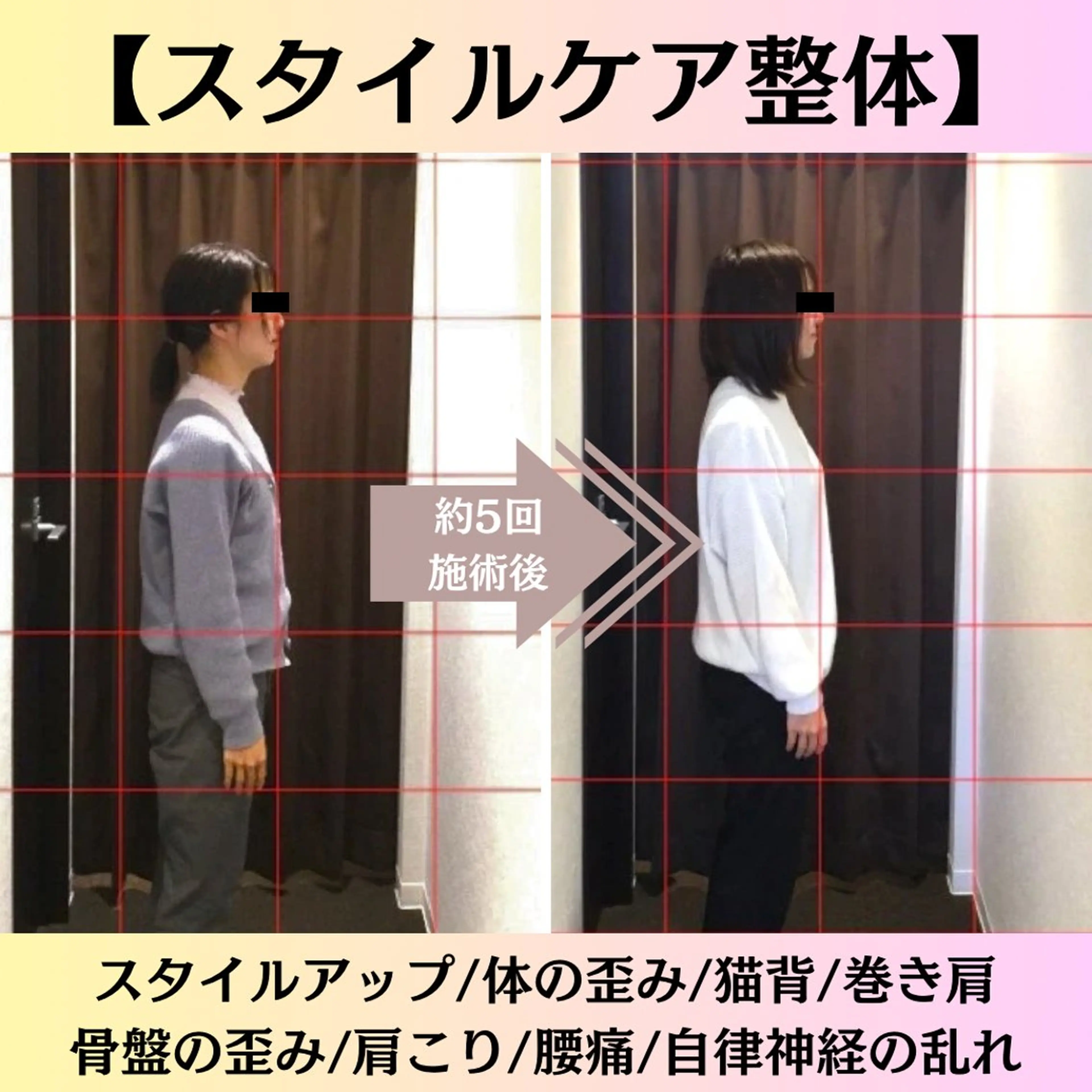 スタイルケア矯正【初めての方はこちら】の写真