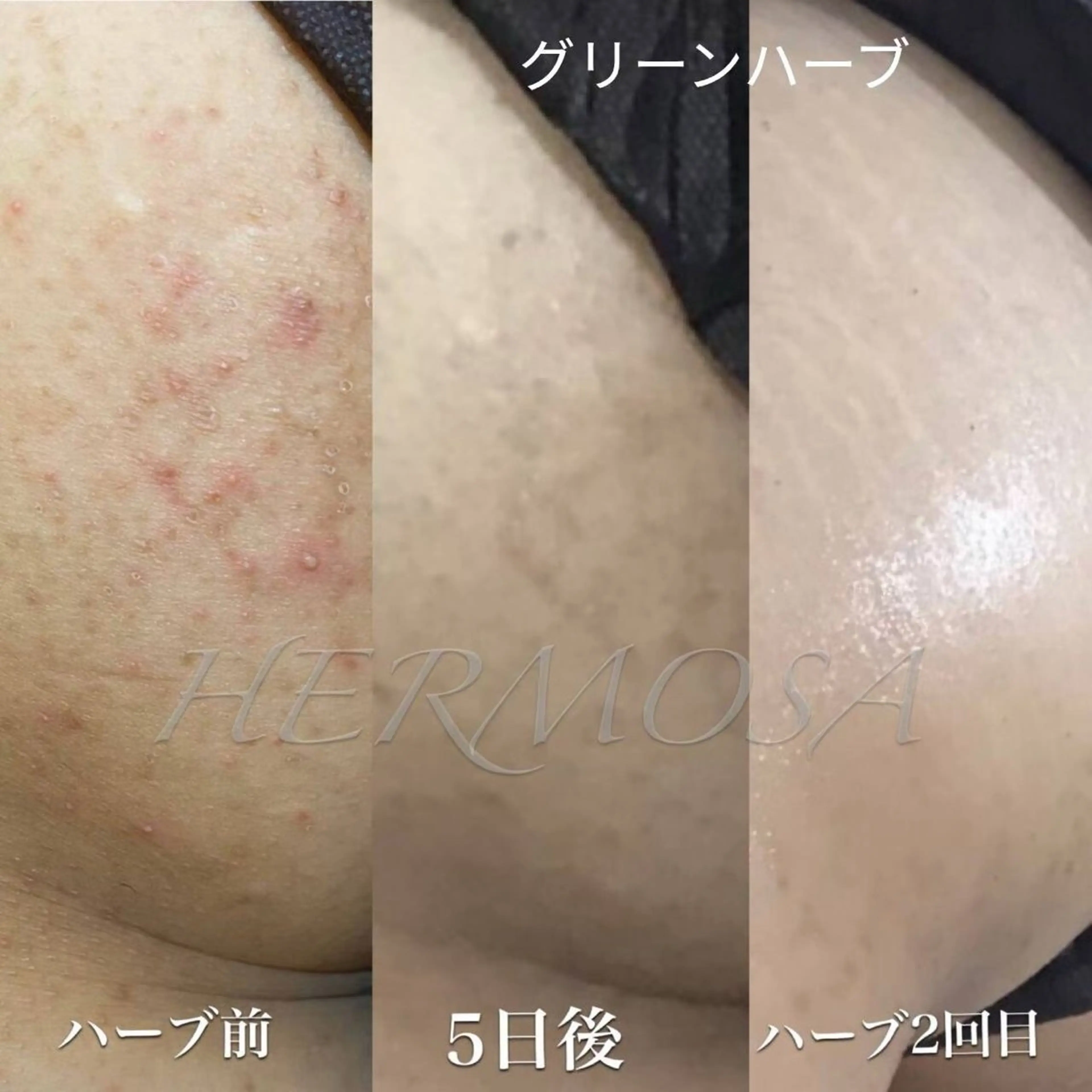 オールハンド フェイシャルのエステ・リラクイメージ