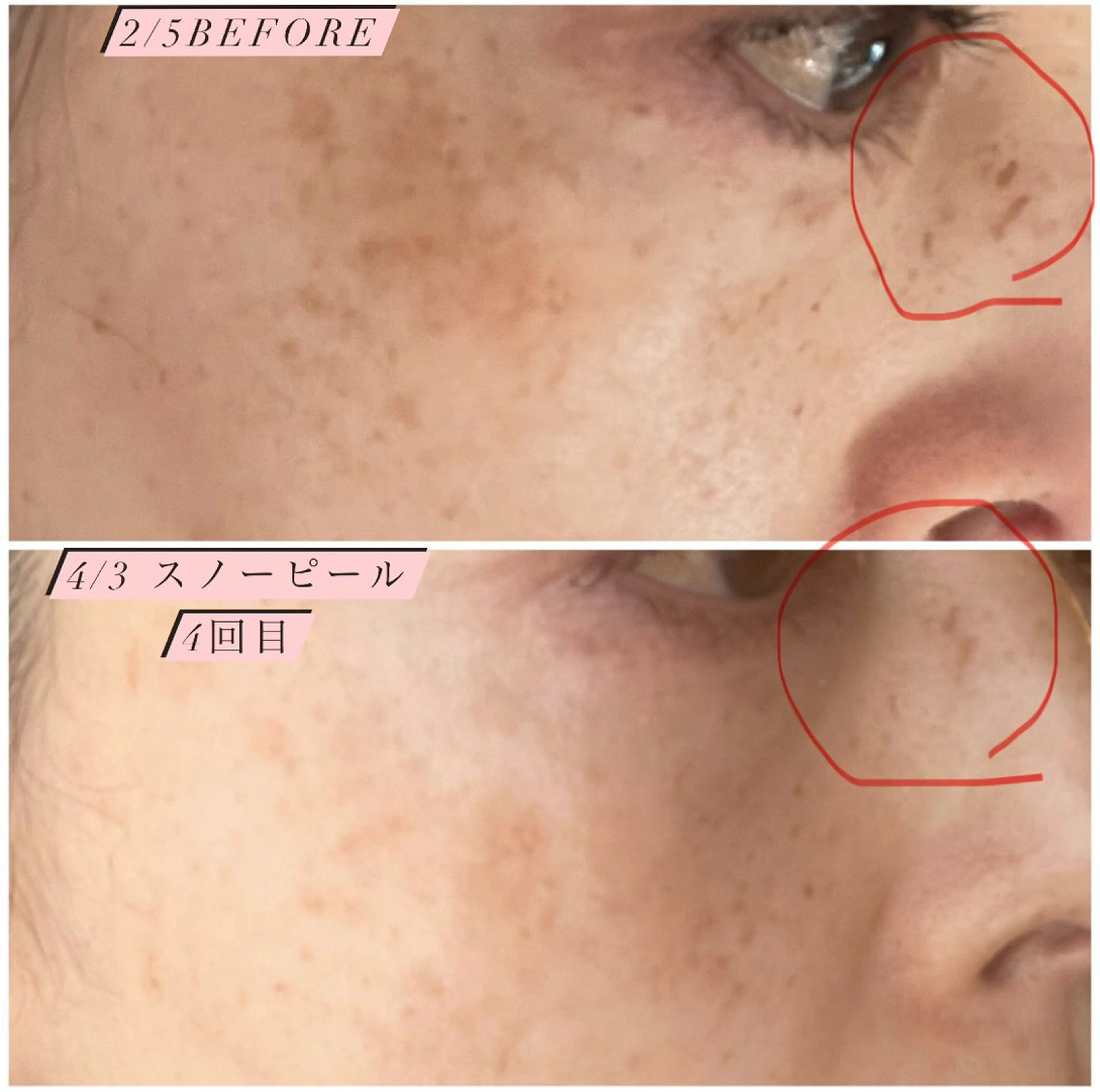 エステ フィユ所属・〚博多〛フィユ 水江のマツエク・マツパデザイン