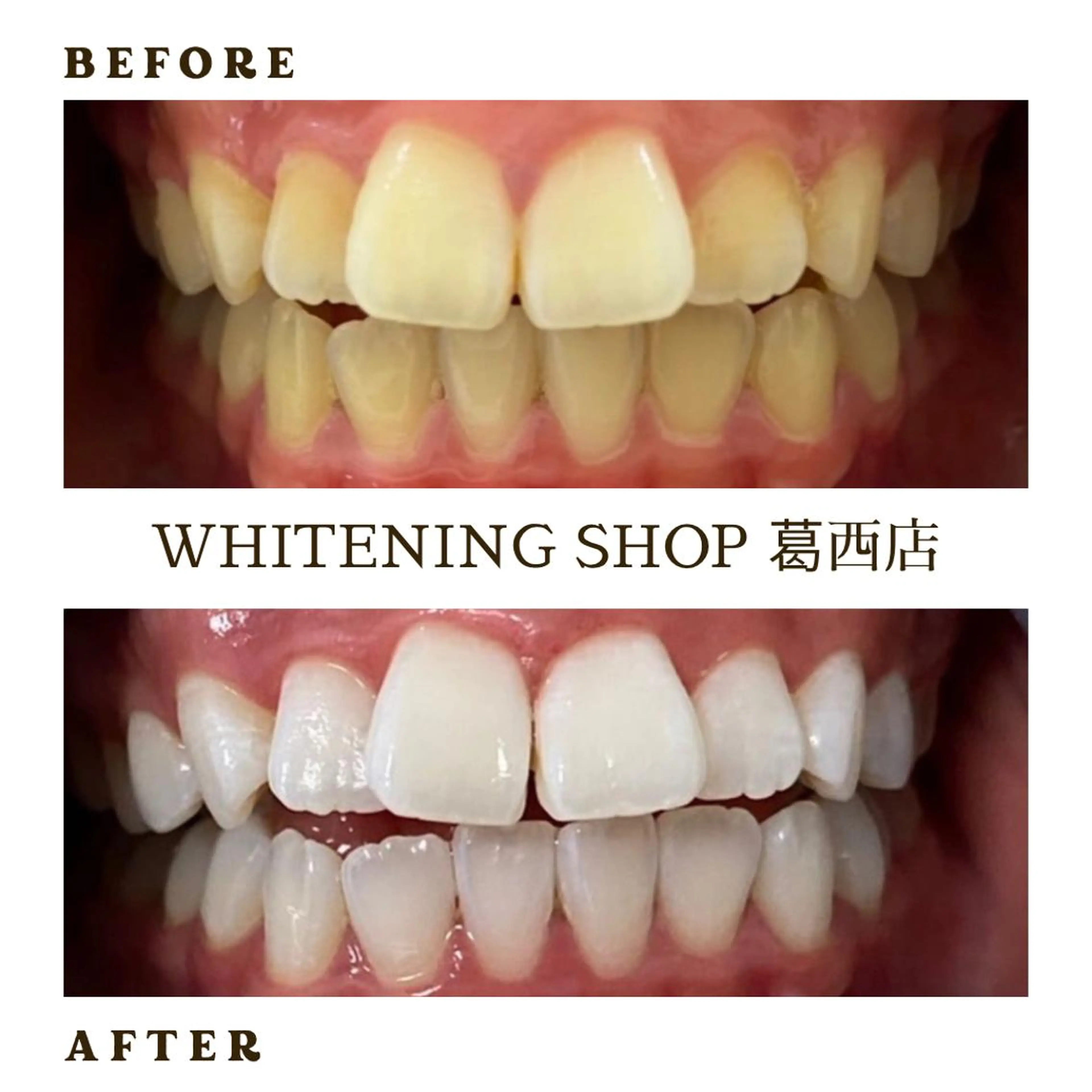 メンズ その他 ホワイトニング ショップ葛西店のその他イメージ