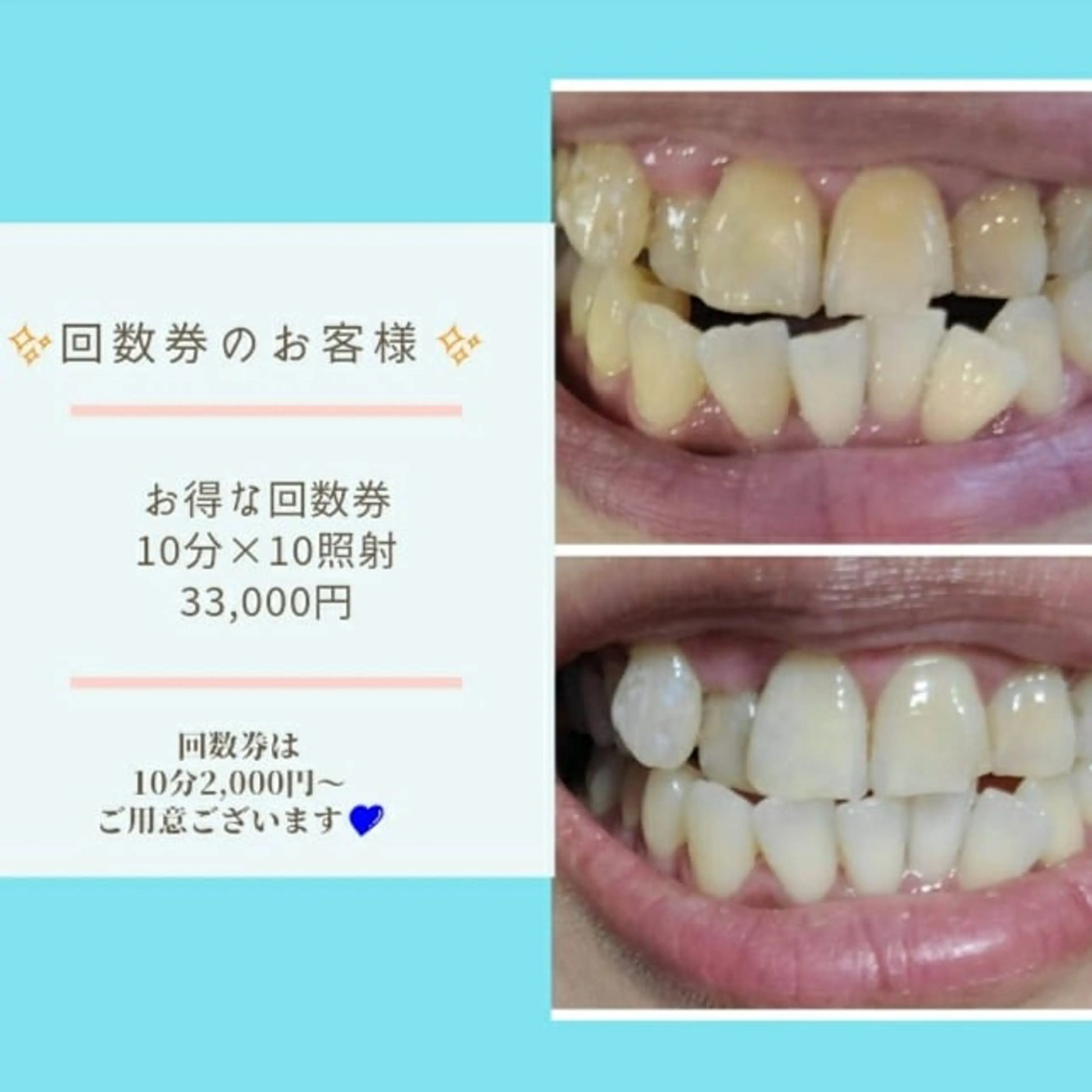 その他 五十嵐 蓮のその他イメージ