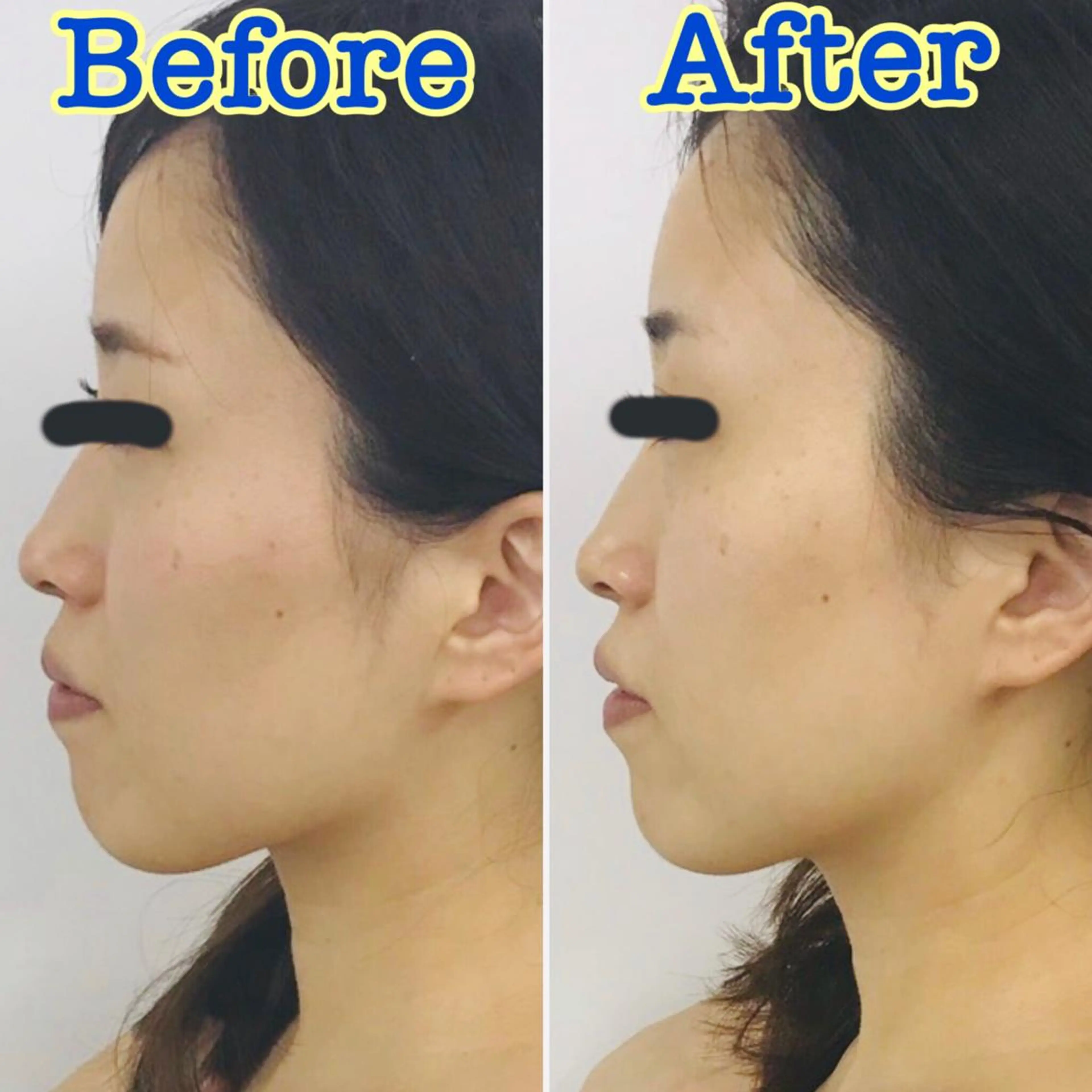 🗻エステティック RAYVIS藤🐈のエステ・リラクイメージ