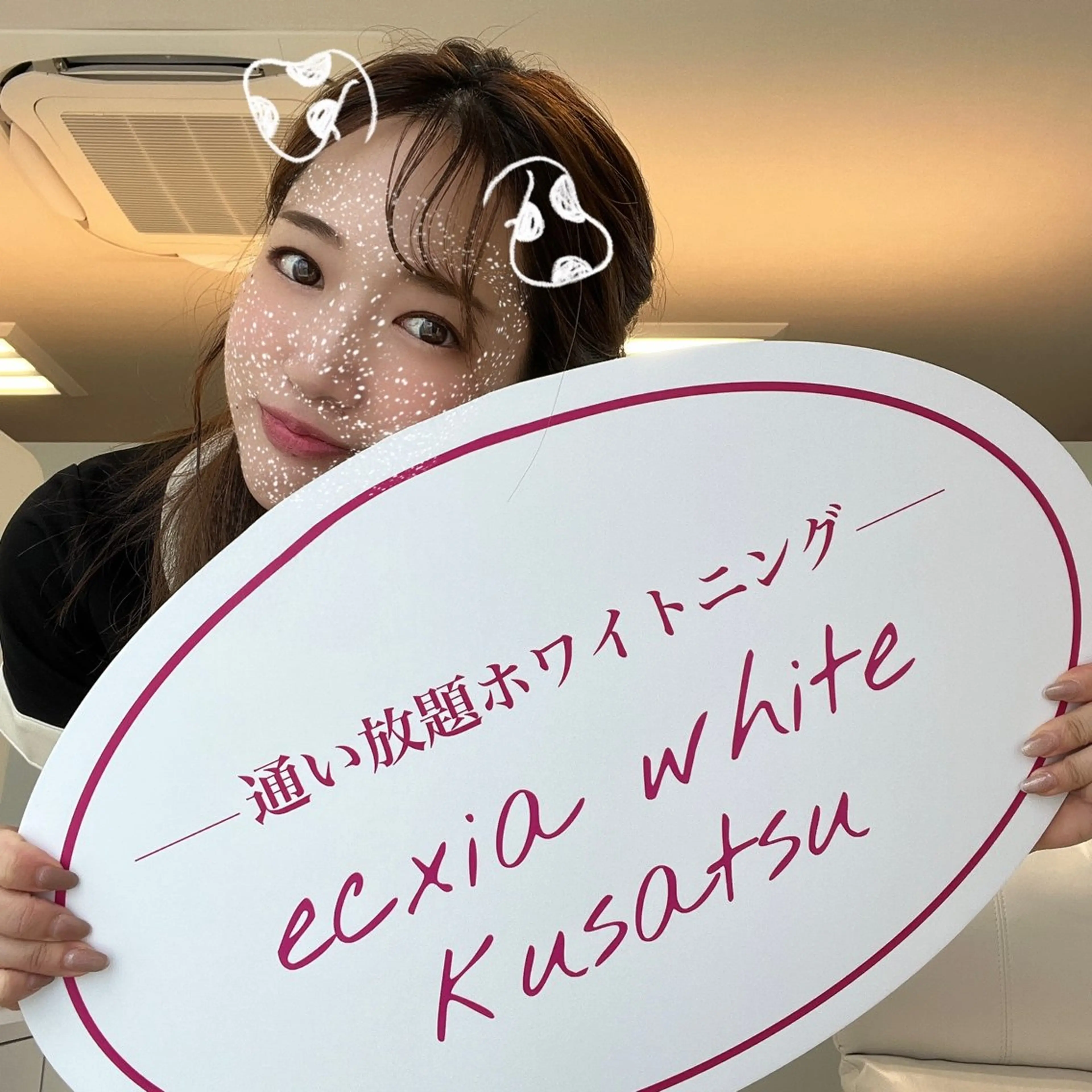 その他 エクシアホワイトニング草津店所属・nanami -ホワイトニングのその他イメージ