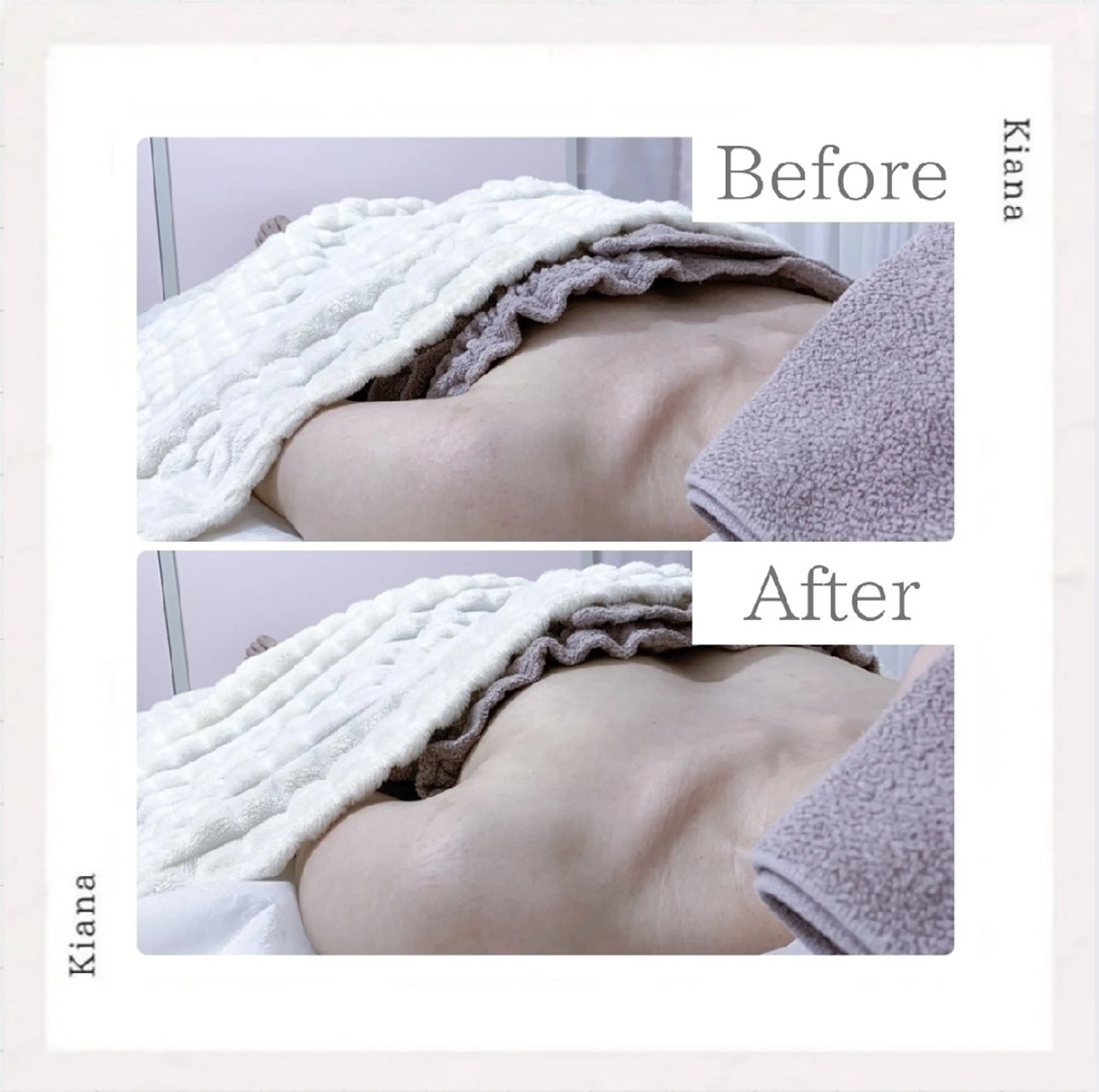 エステ リラク 【バスト専門店 】 Kiana のエステ・リラクイメージ