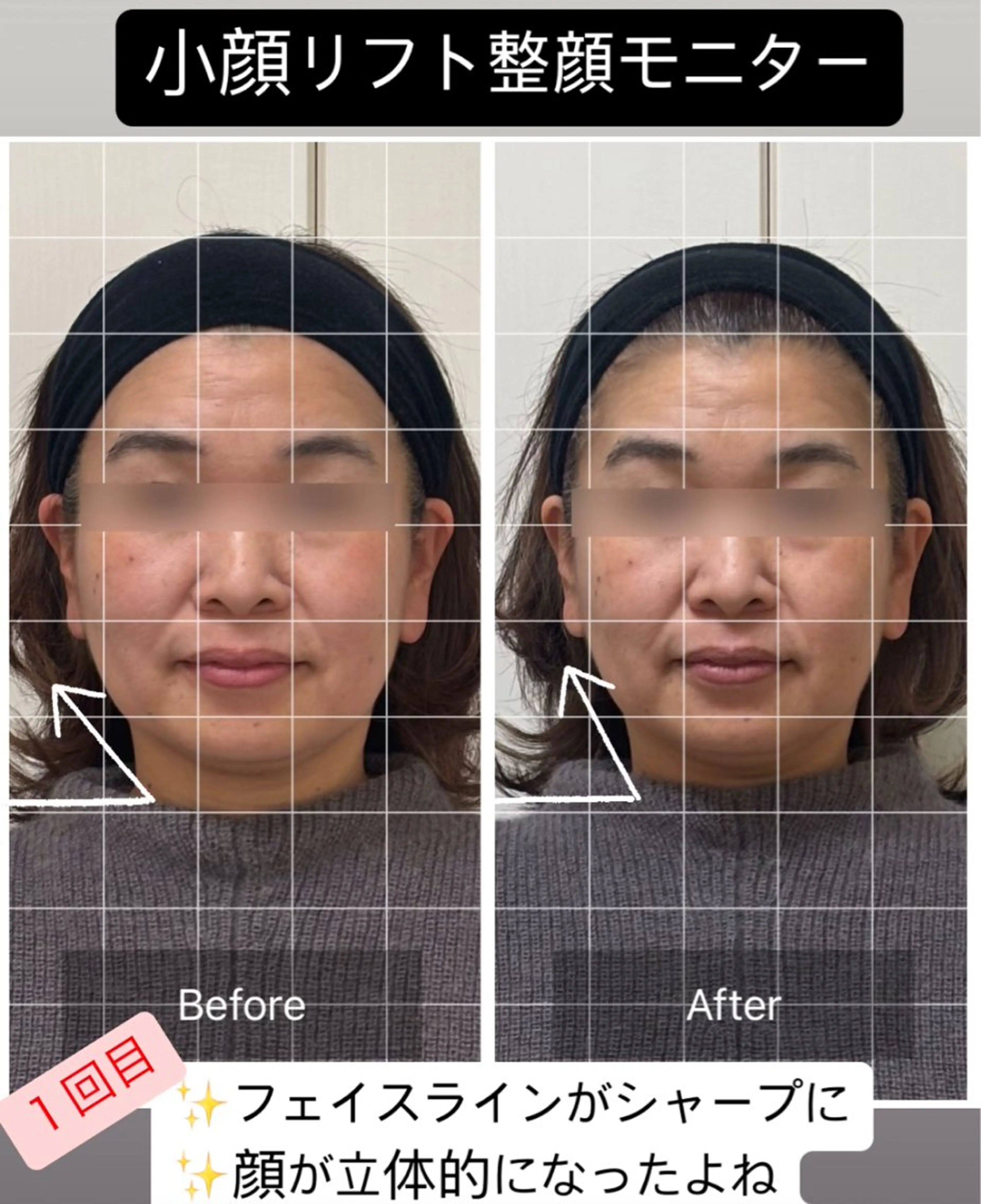 その他 小顔リフト整顔/ 美肌サロンのその他イメージ