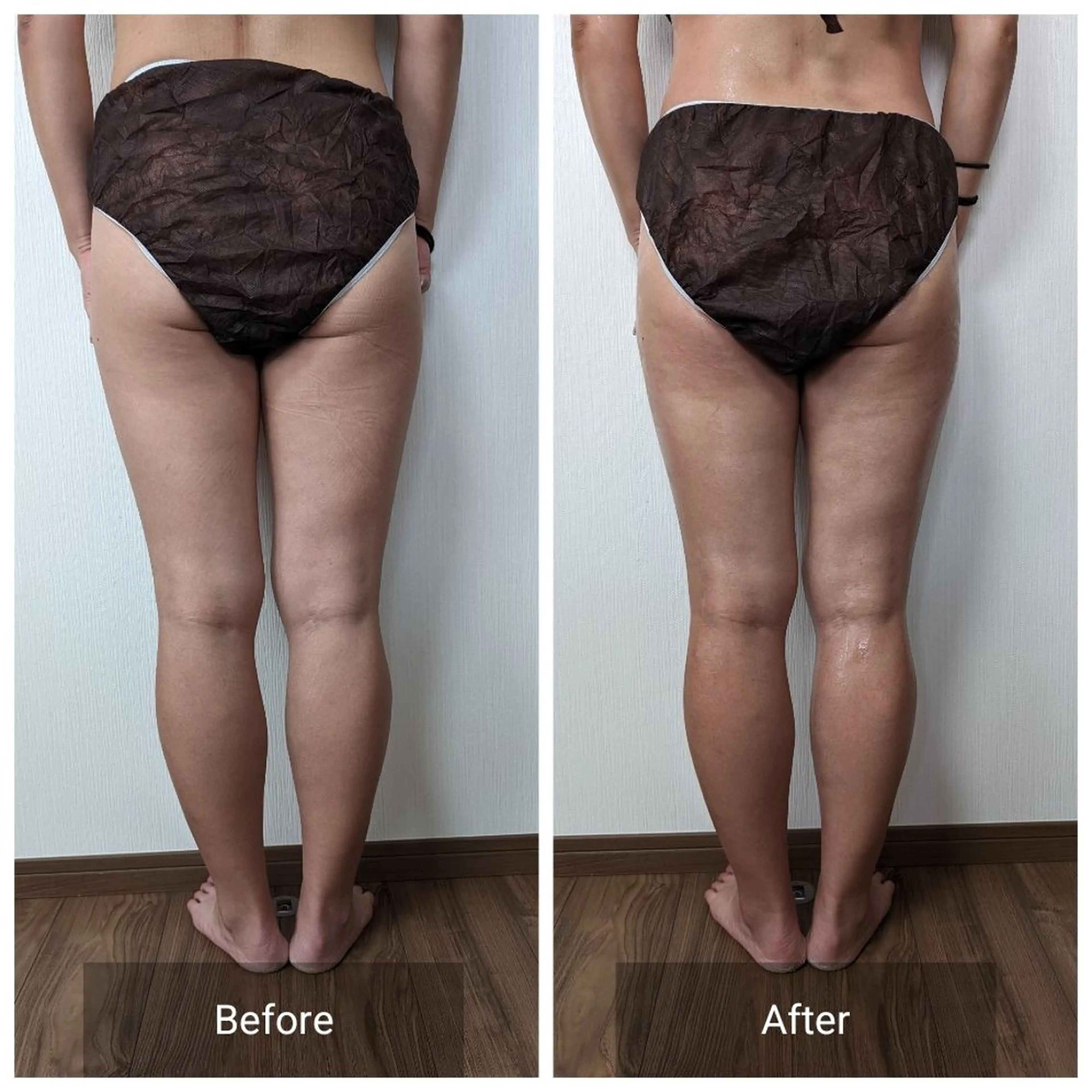 エステ リラク nail RiRi アトレナチュラのエステ・リラクイメージ