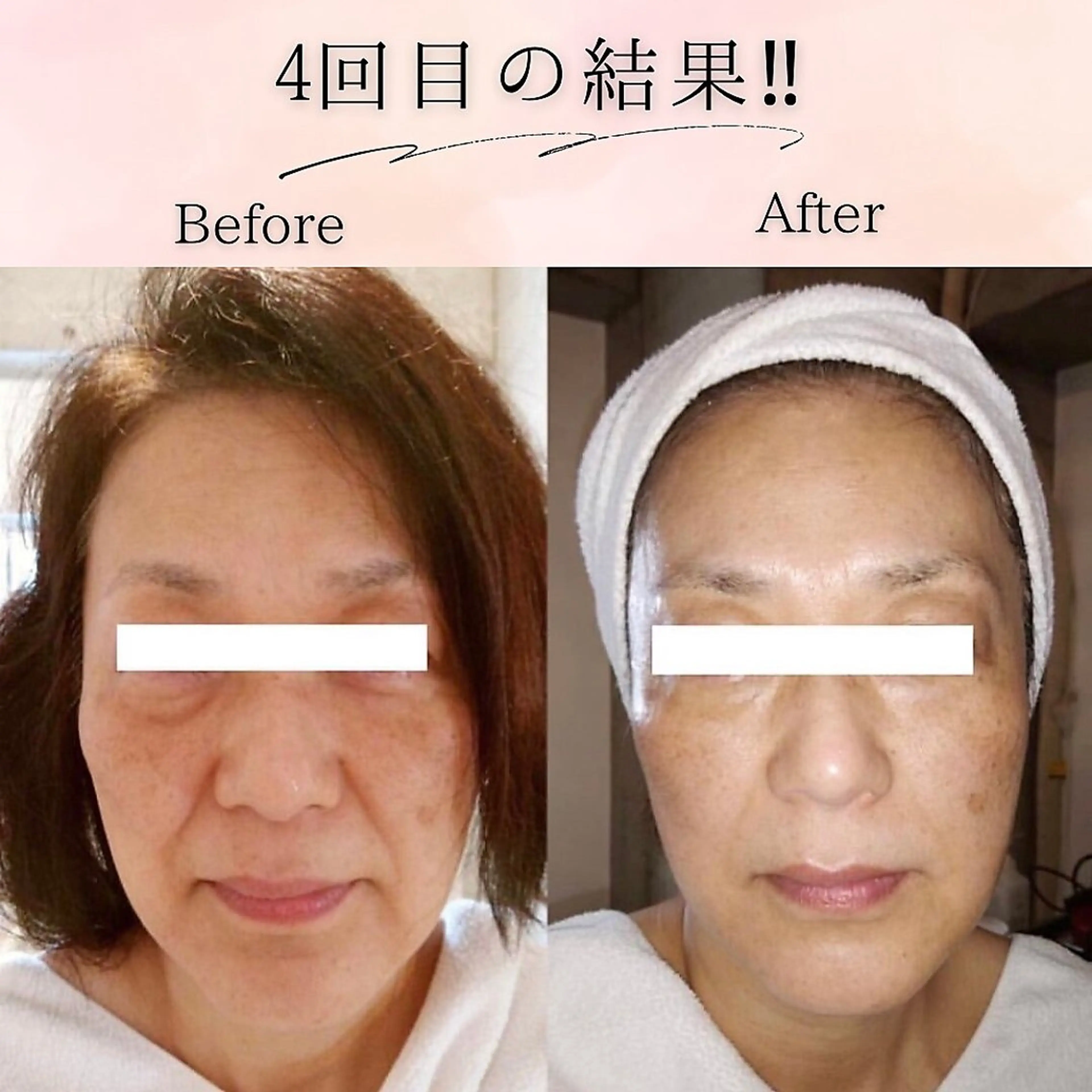 エステ SELF  BEAUTY gracia浦添店所属・gracia 浦添店のその他イメージ