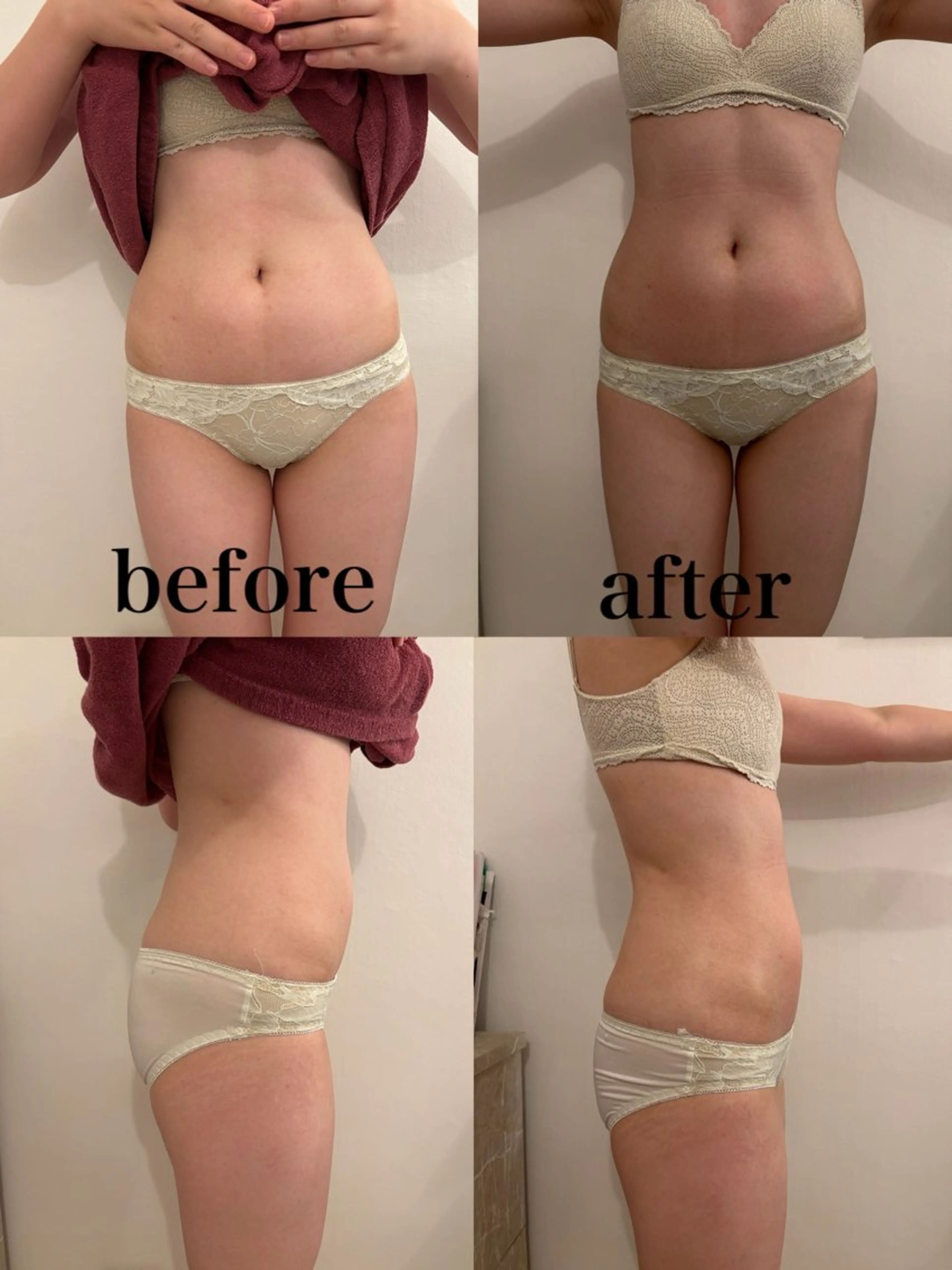 その他 腸活サポート みなみののエステ・リラクイメージ