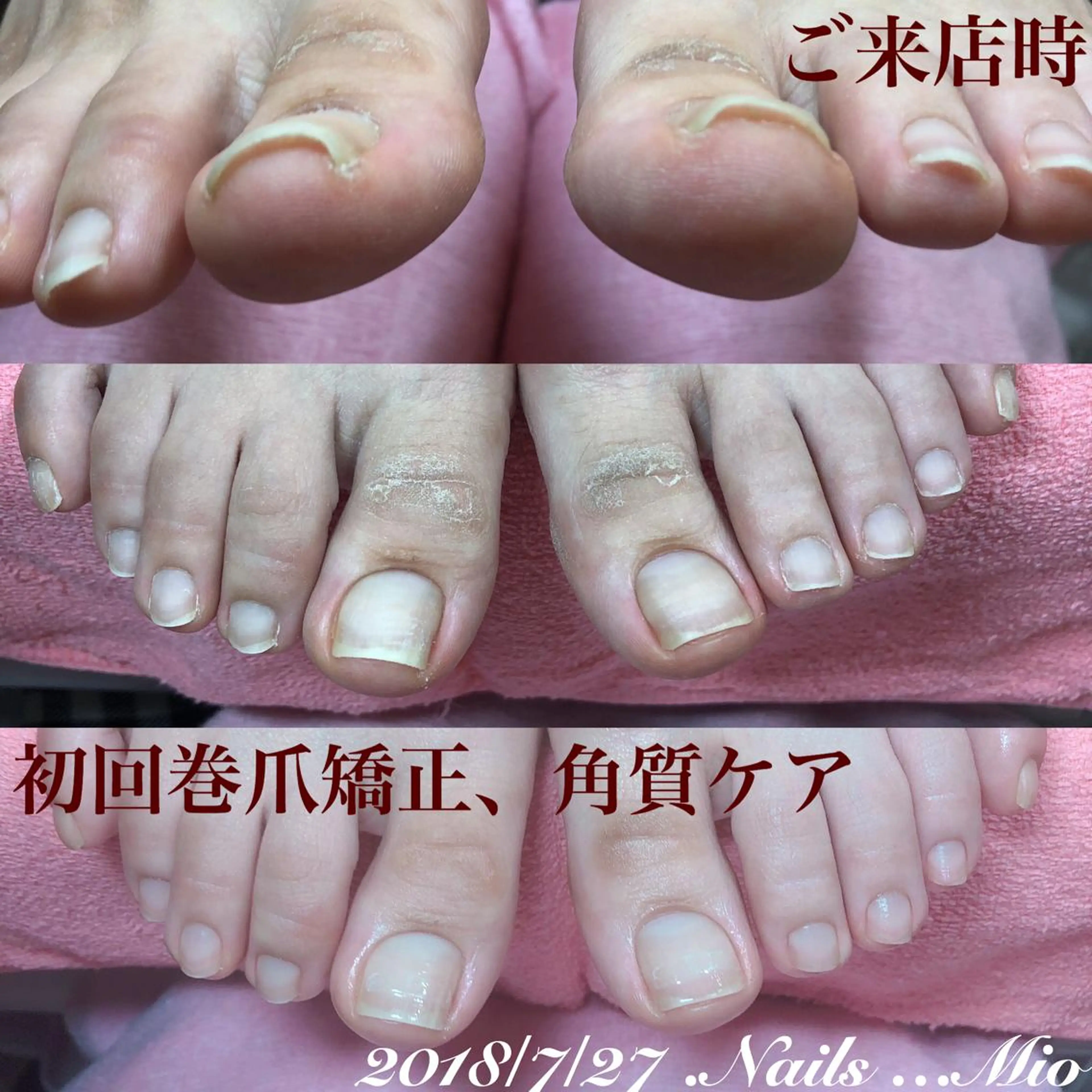 ネイル フットネイル .Nails Mio 赤羽西ネイルサロンのネイルデザイン