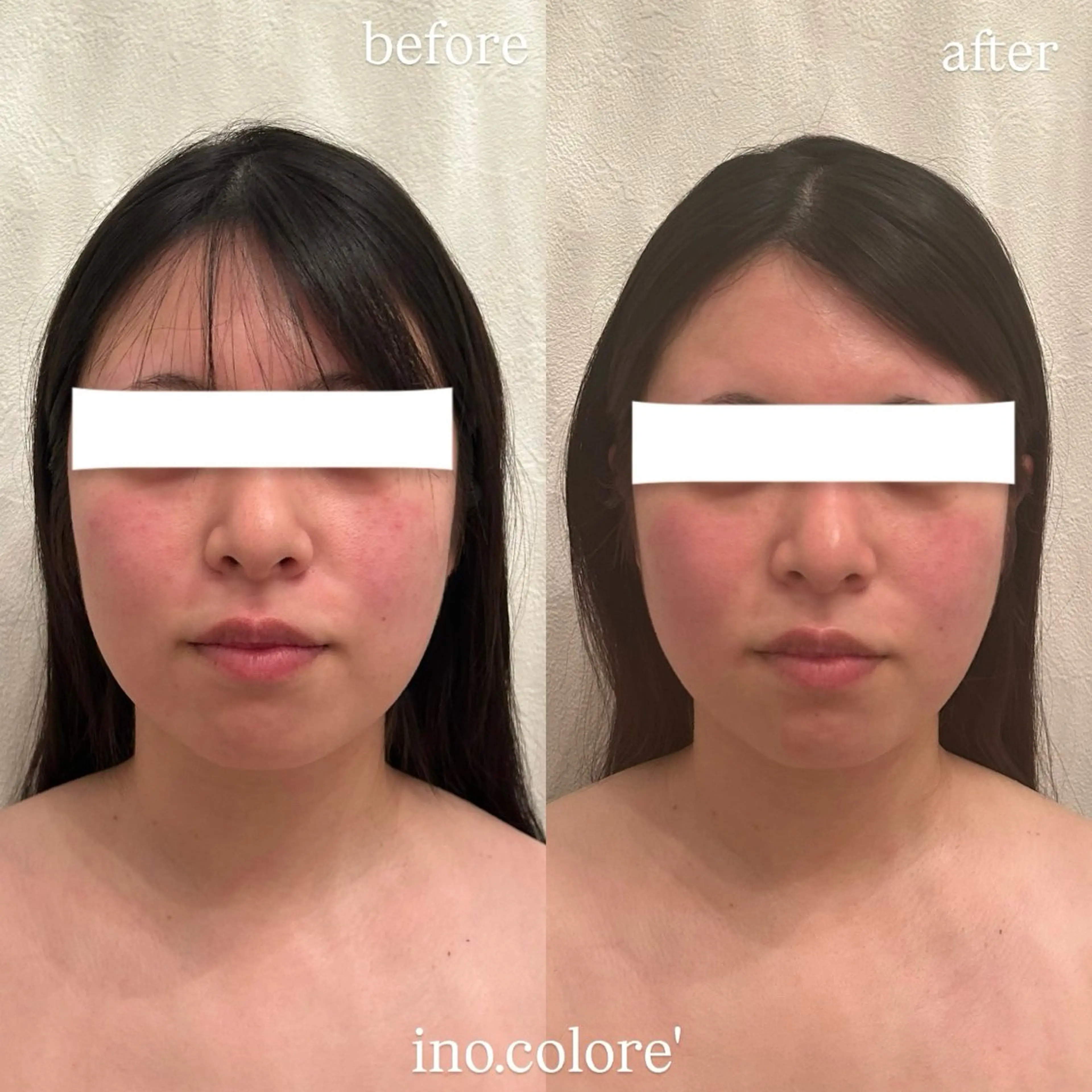 エステ リラク エステサロンino.colore'所属・小顔サロン ino.coloreのエステ・リラクイメージ