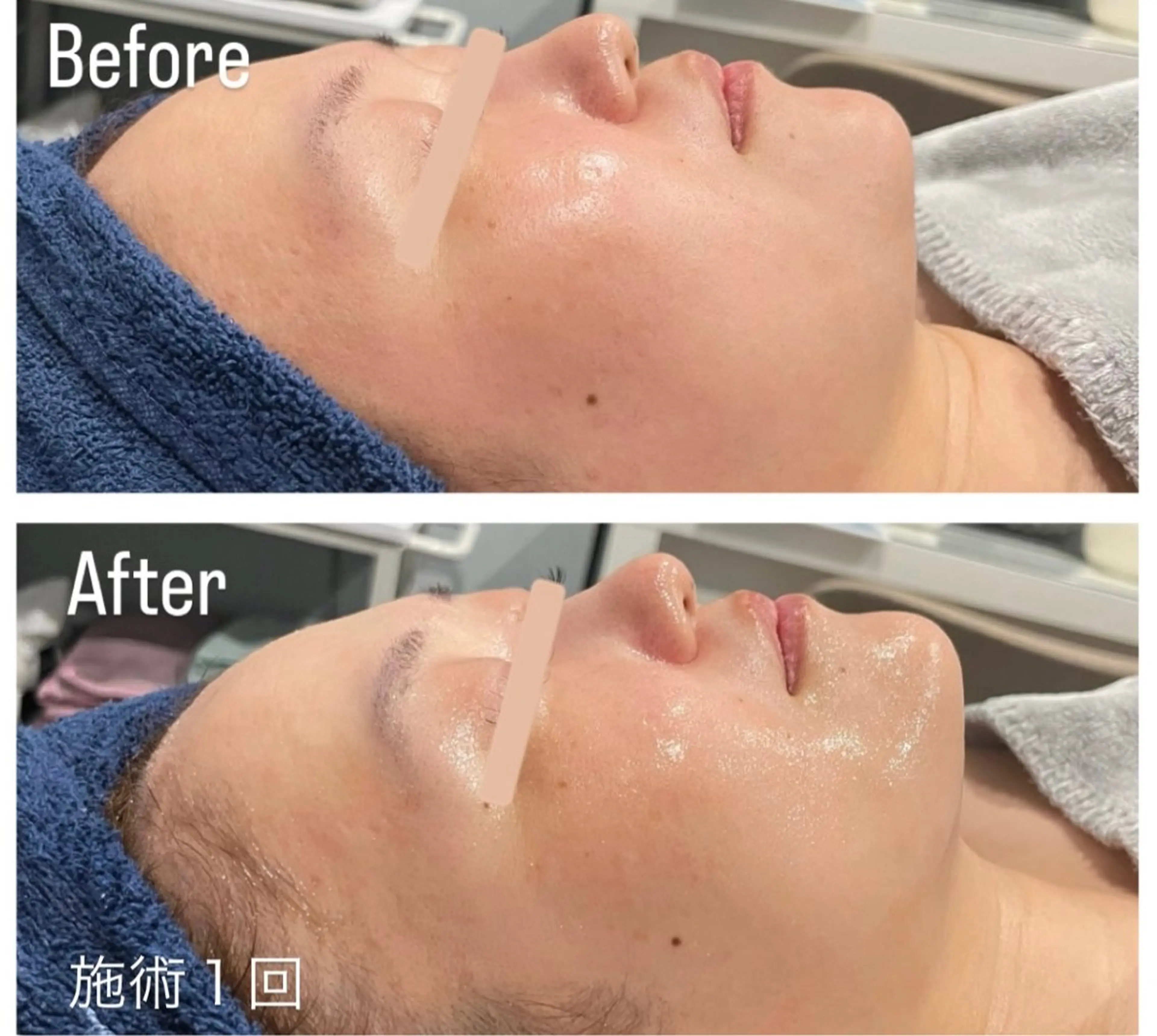 アンド ミルルのエステ・リラクイメージ