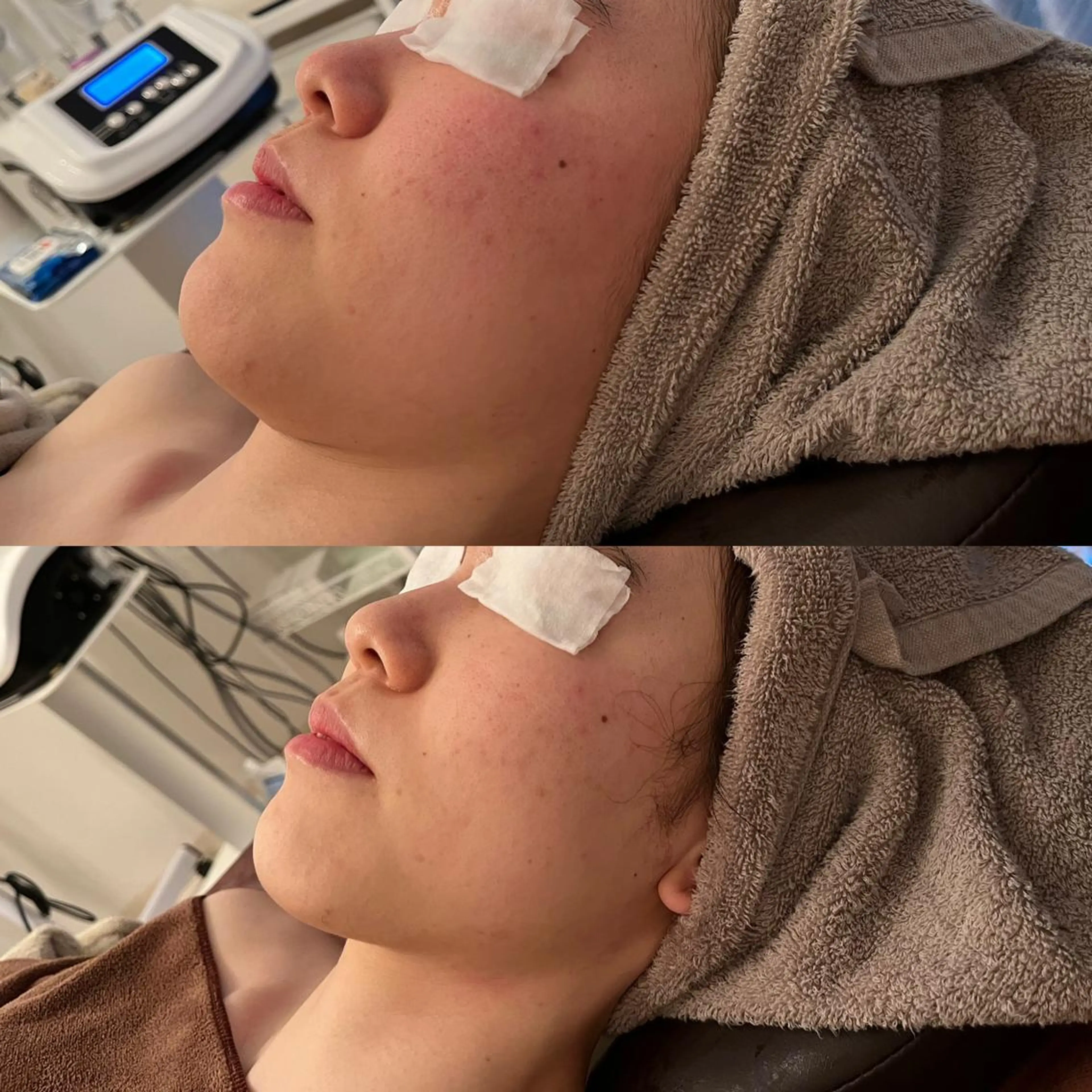 Remina clinical salon所属・ハイフ美肌専門 Remina.c.sのエステ・リラクイメージ