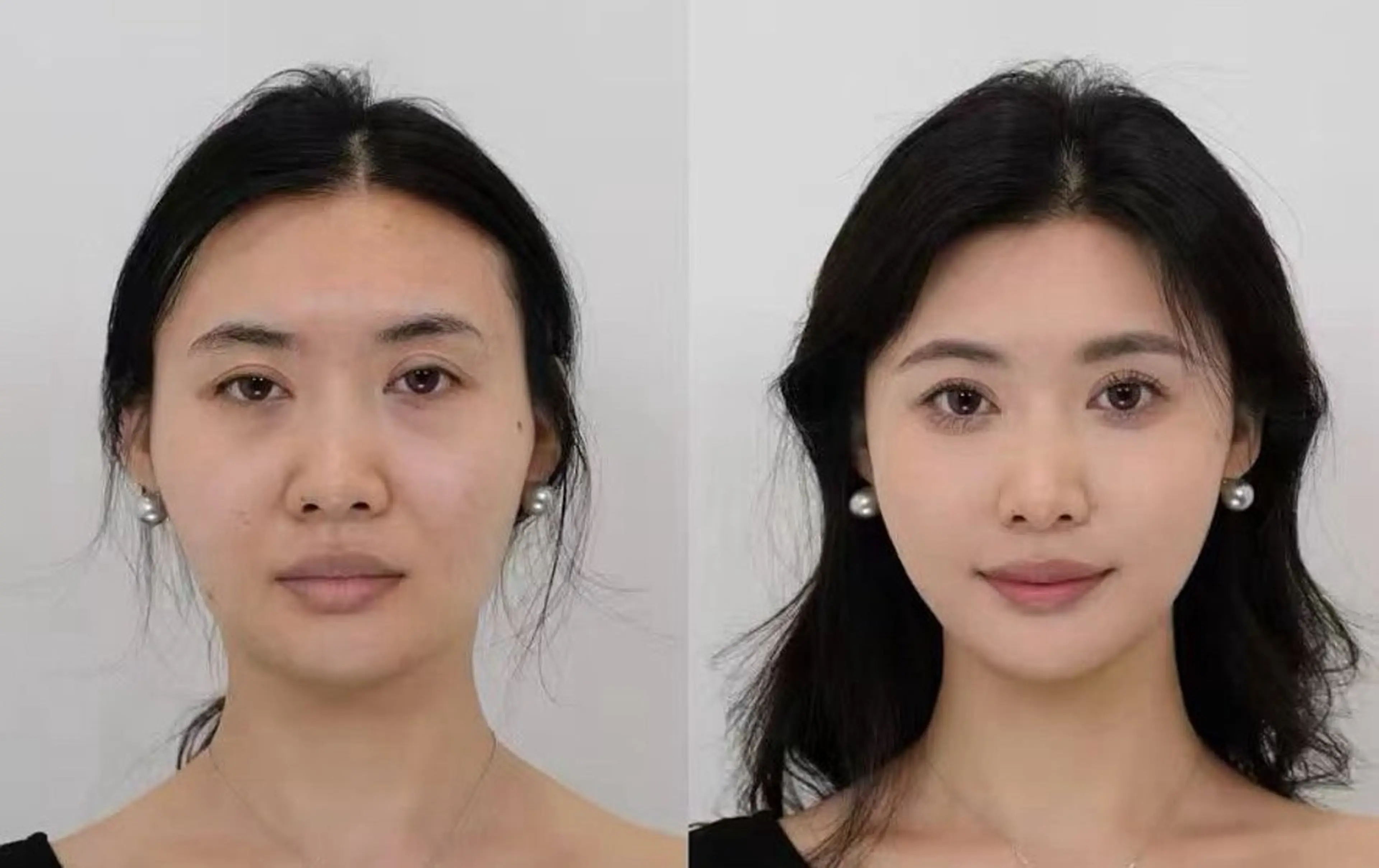 カラー エステ aliaハイフ&水光ジェットサロン所属・aliaハーブ水光店 エステティシャン募集のエステ・リラクイメージ