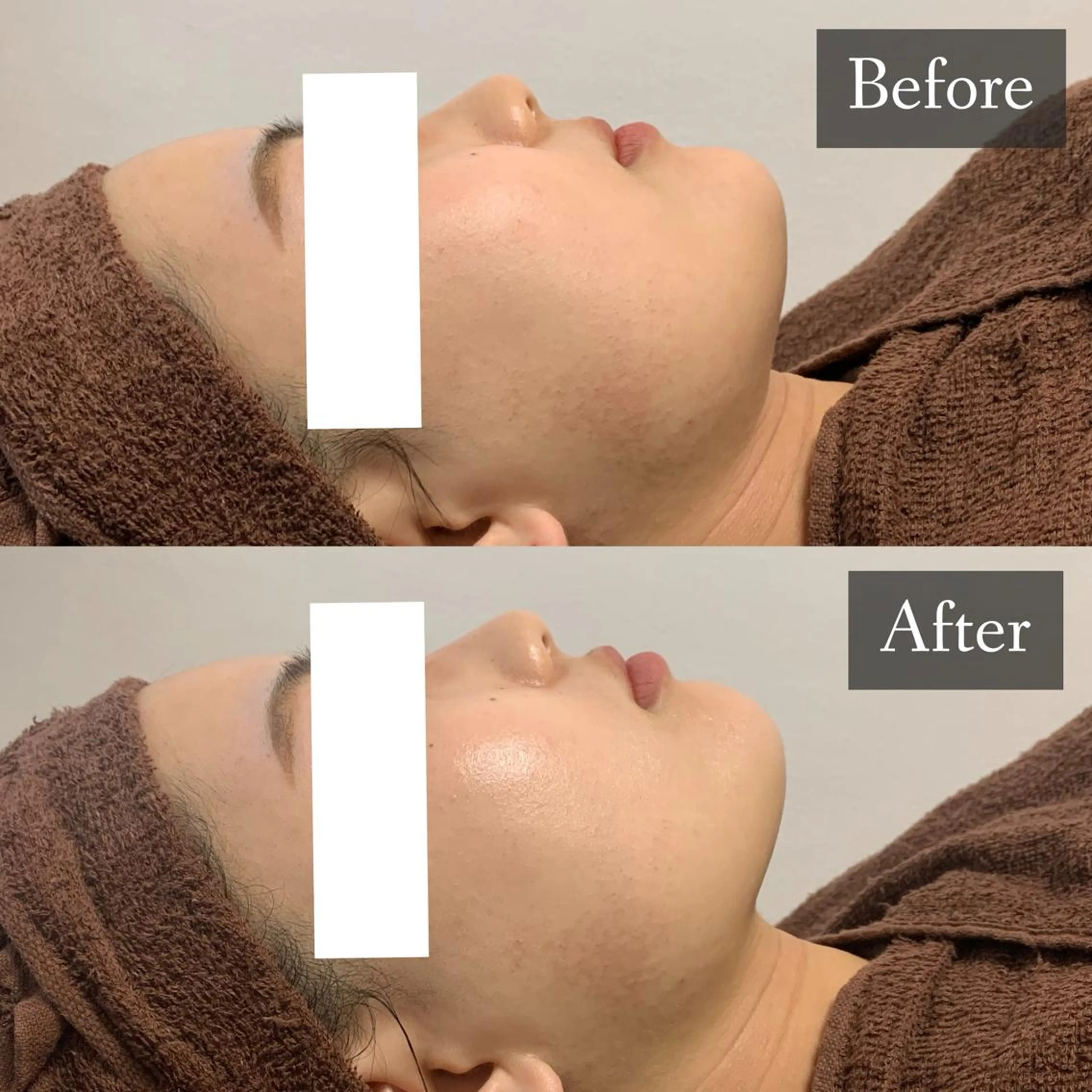 脱毛専門サロン BELFINE恵比寿のエステ・リラクイメージ