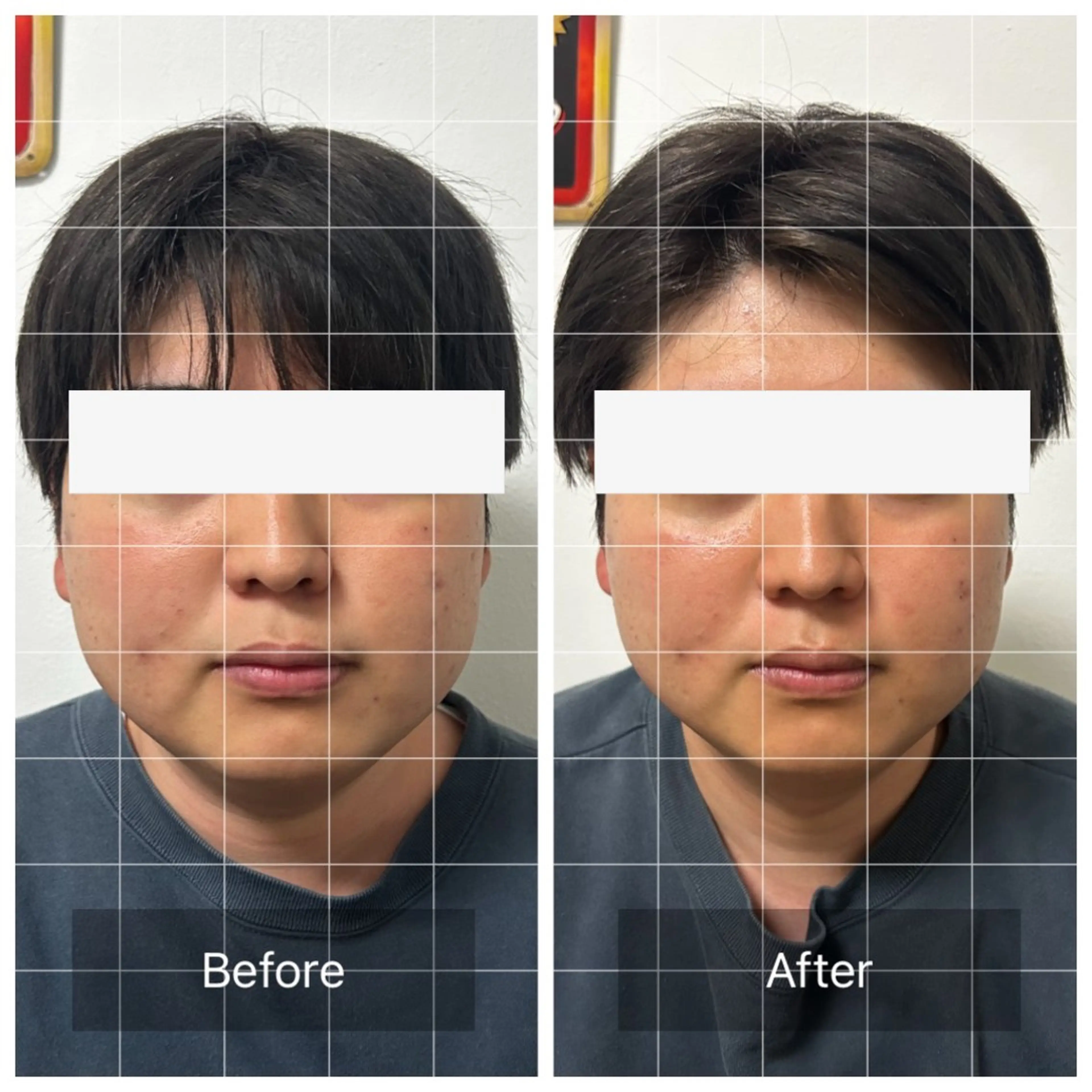 メンズ リラク エマニエル USAのエステ・リラクイメージ