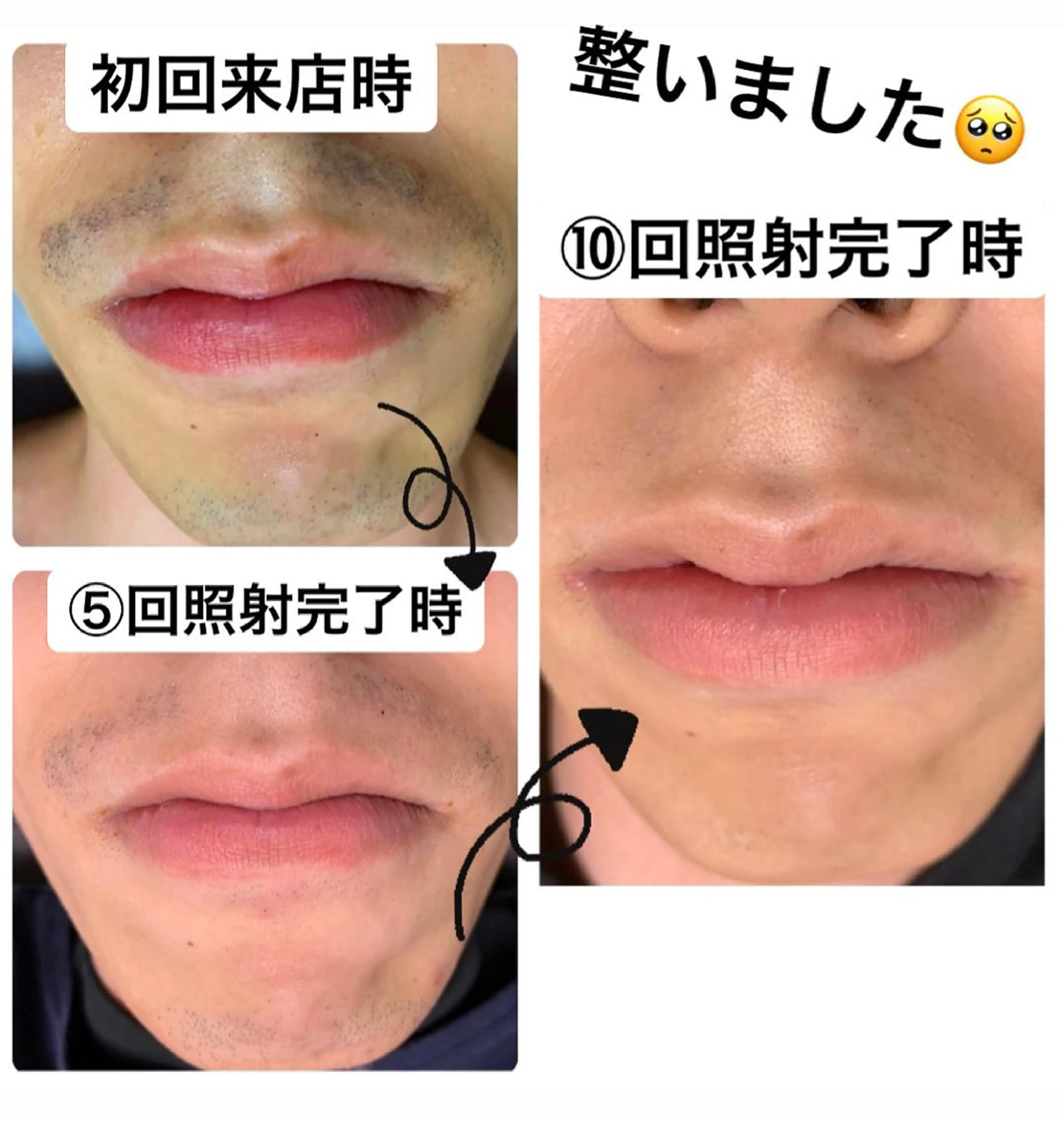 脱毛 メンズ脱毛サロン Le falcoのエステ・リラクイメージ