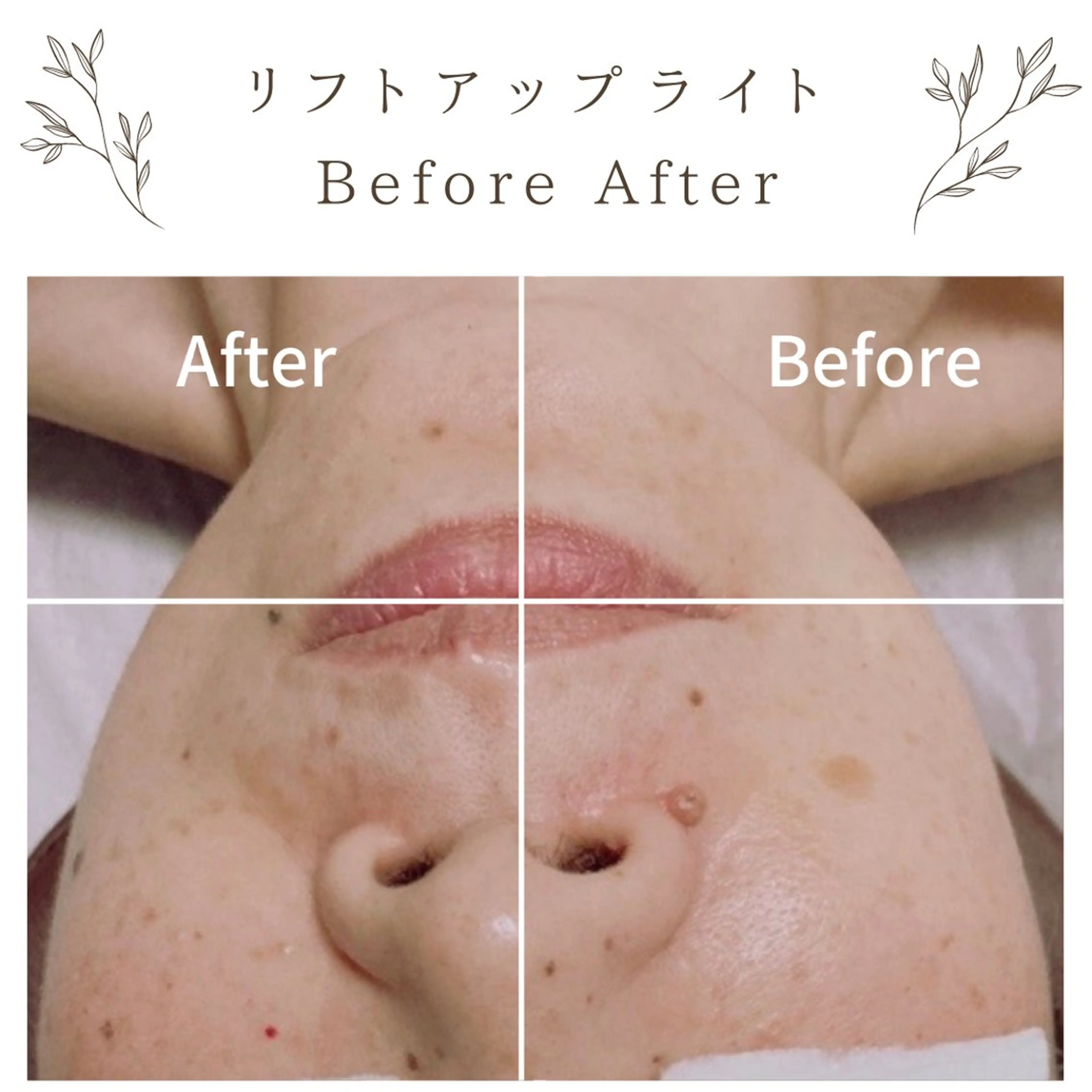 な ぎのエステ・リラクイメージ