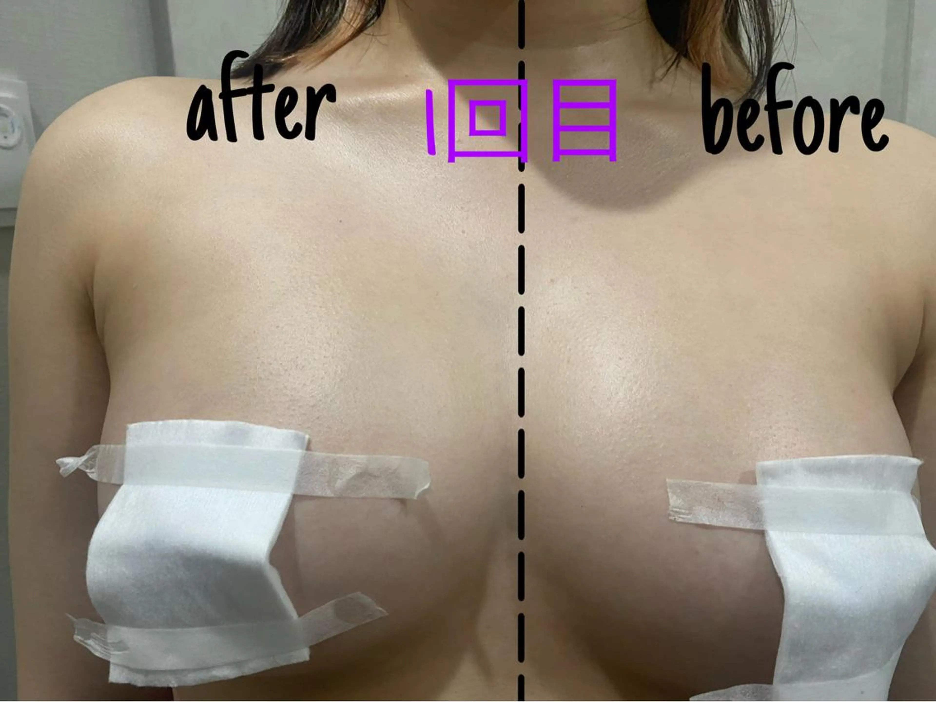 アルカンジュ~archange~所属・痩身/毛穴洗浄/脱毛 アルカンジュのエステ・リラクイメージ