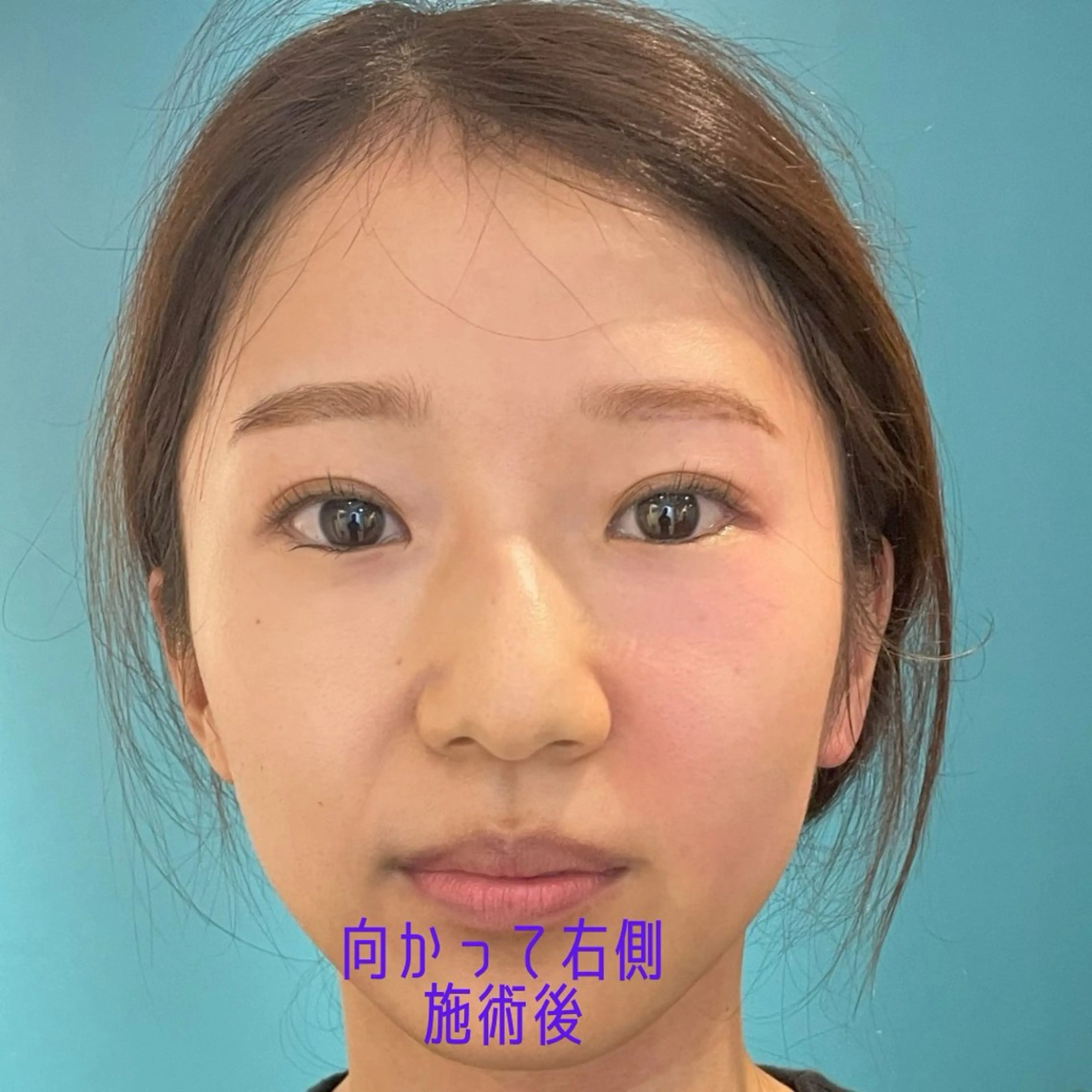 エステ Nexfit for Beauty小顔矯正のエステ・リラクイメージ