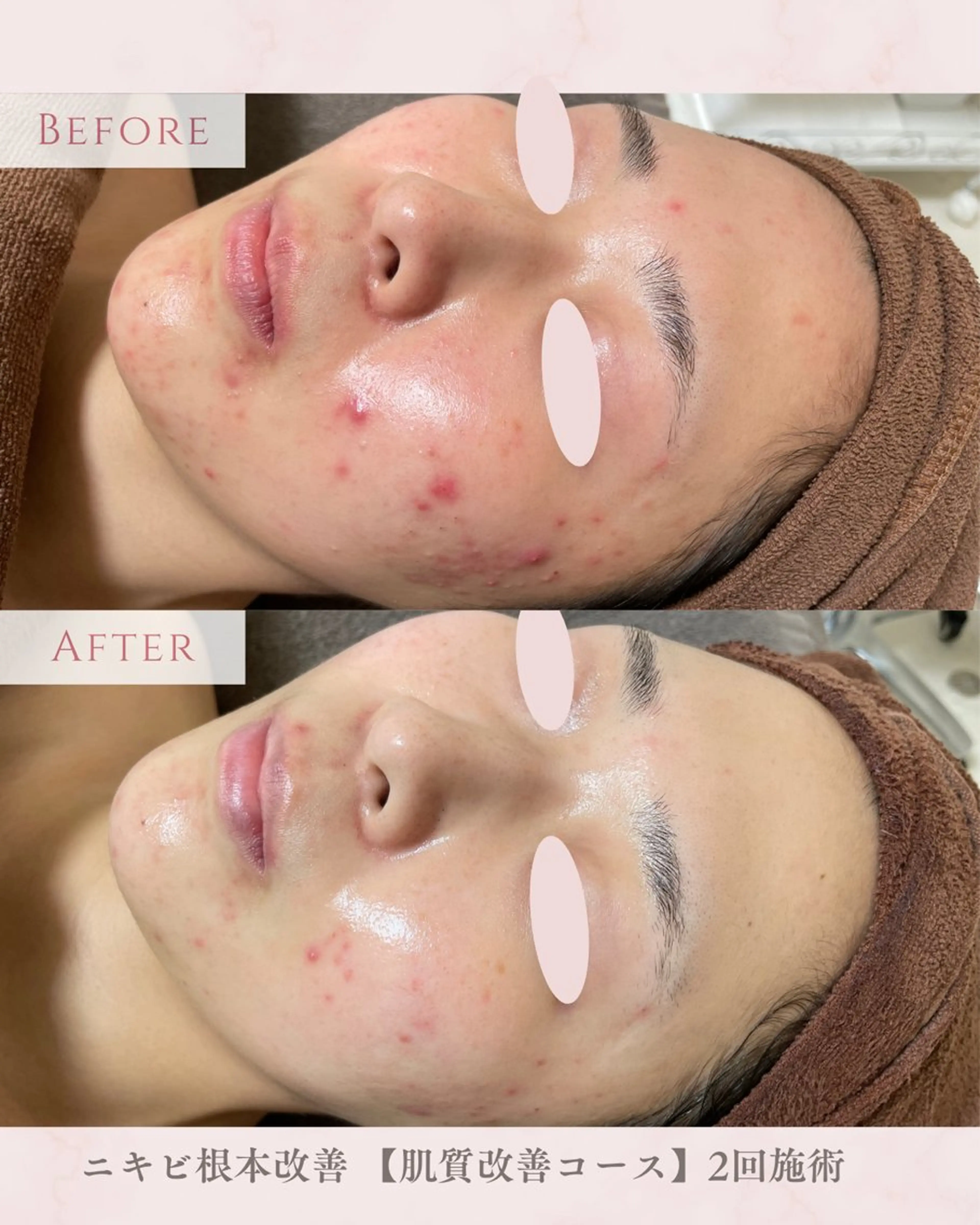 エステ 肌質改善サロン LesFleursのエステ・リラクイメージ