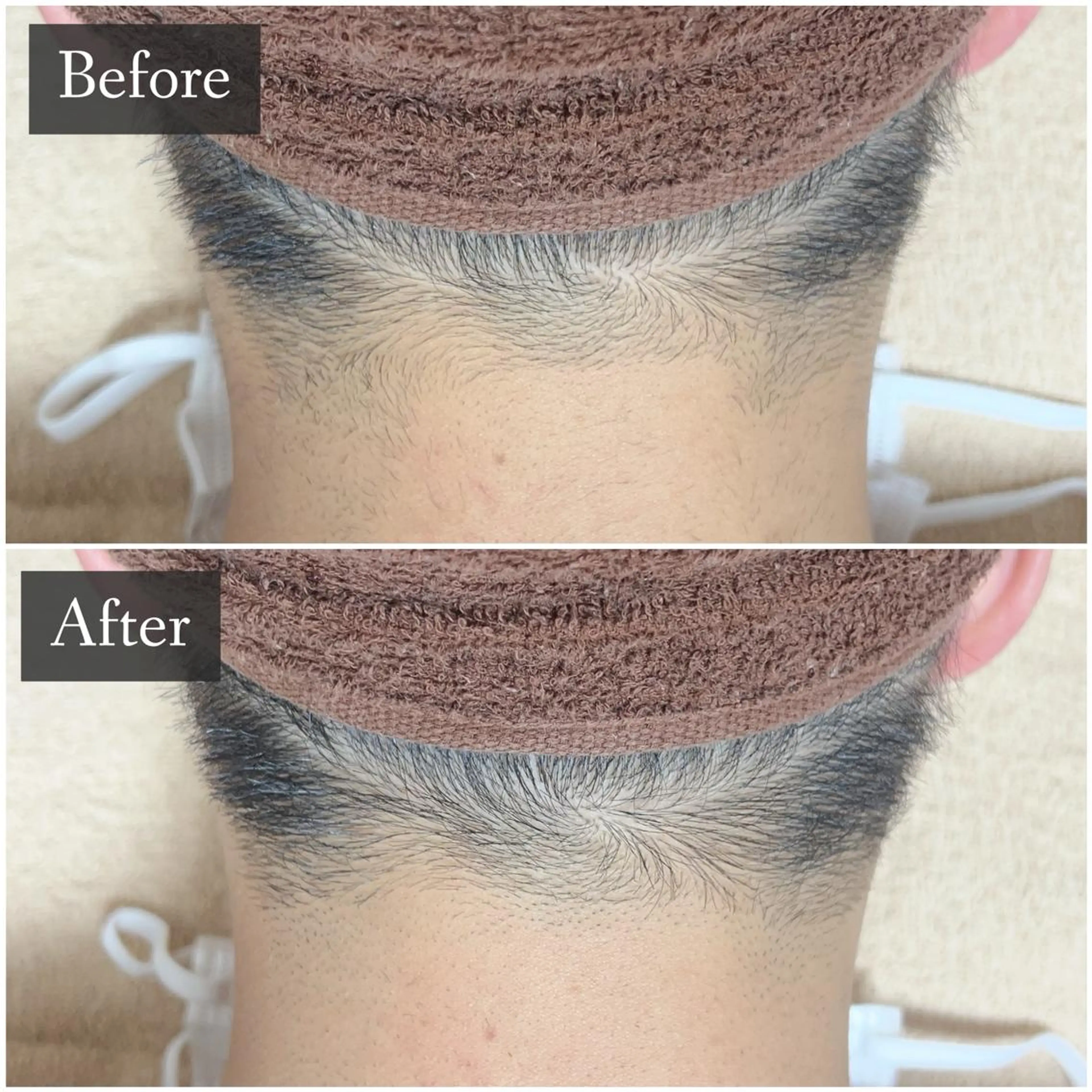 脱毛 脱毛専門サロン BELFINE恵比寿のエステ・リラクイメージ