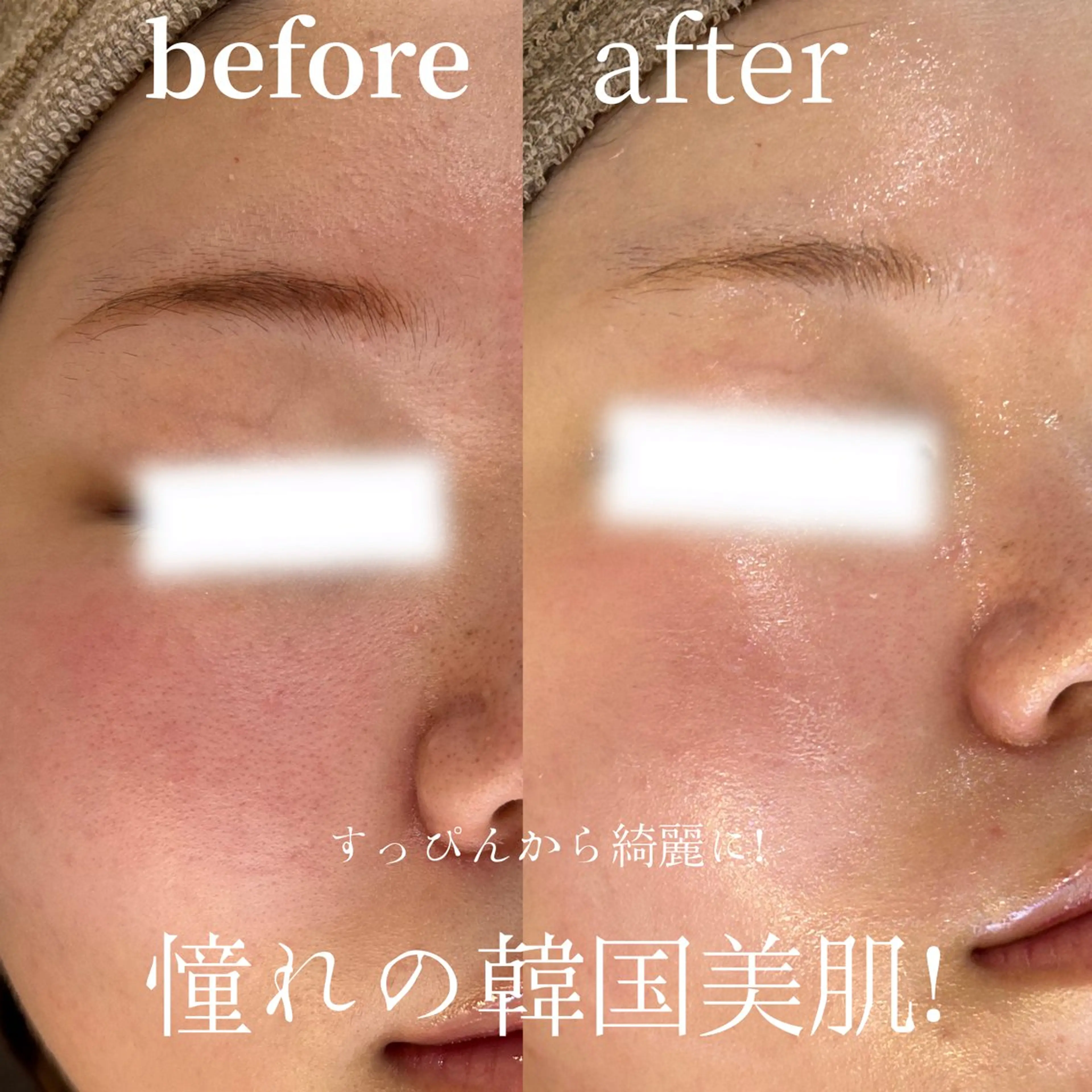 韓国美肌WAXの写真