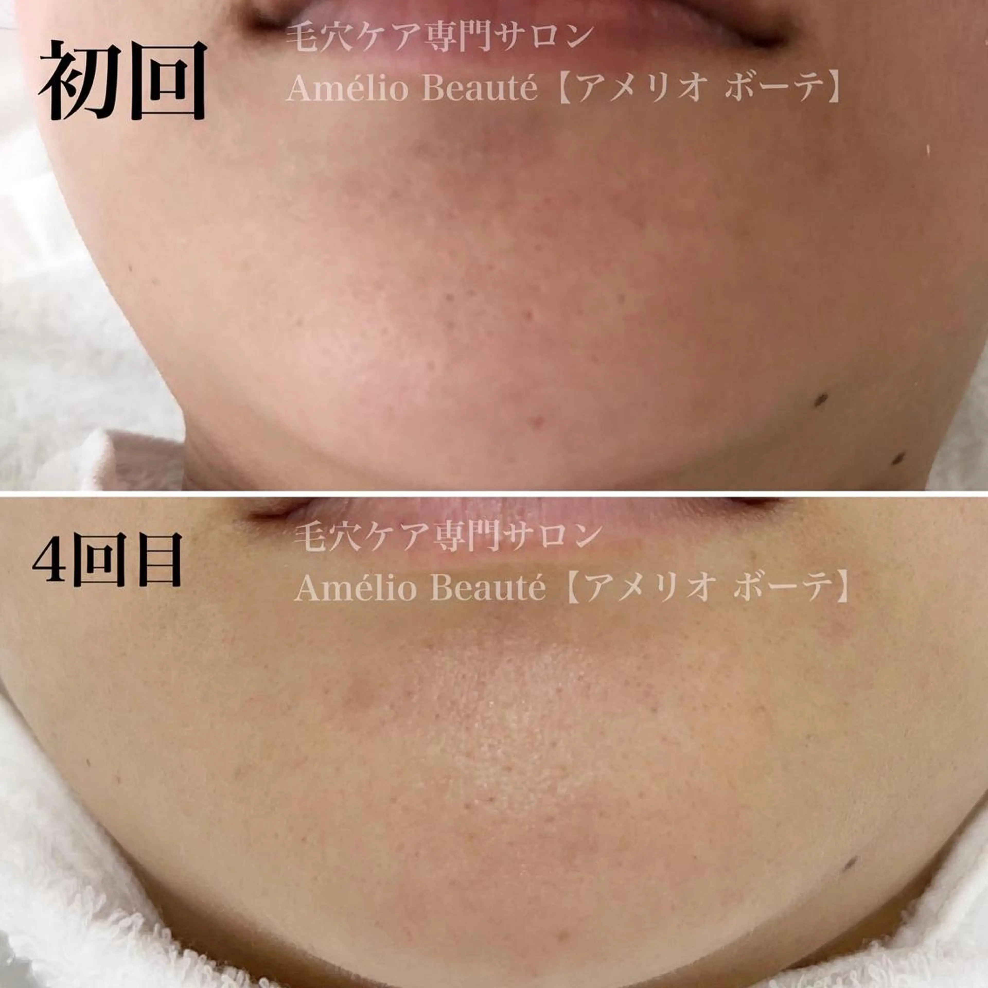 毛穴ケア専門サロン Amélio Beauté所属・毛穴ケア専門サロン アメリオボーテのその他イメージ